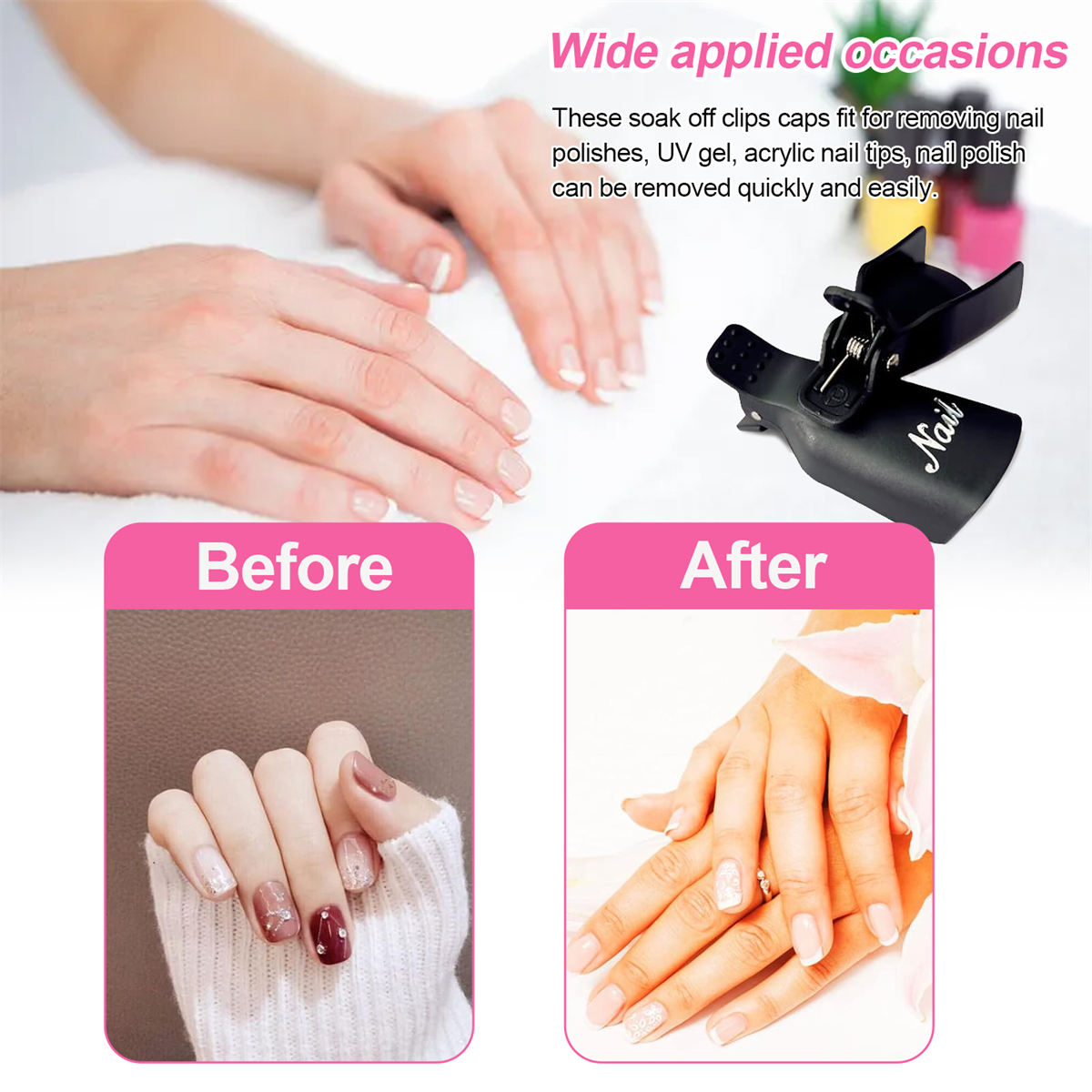 Vorher-Nachher-Bilder einer Nagelmaniküre mit Nagel-Ablöseklemmen, mit Textüberlagerung.