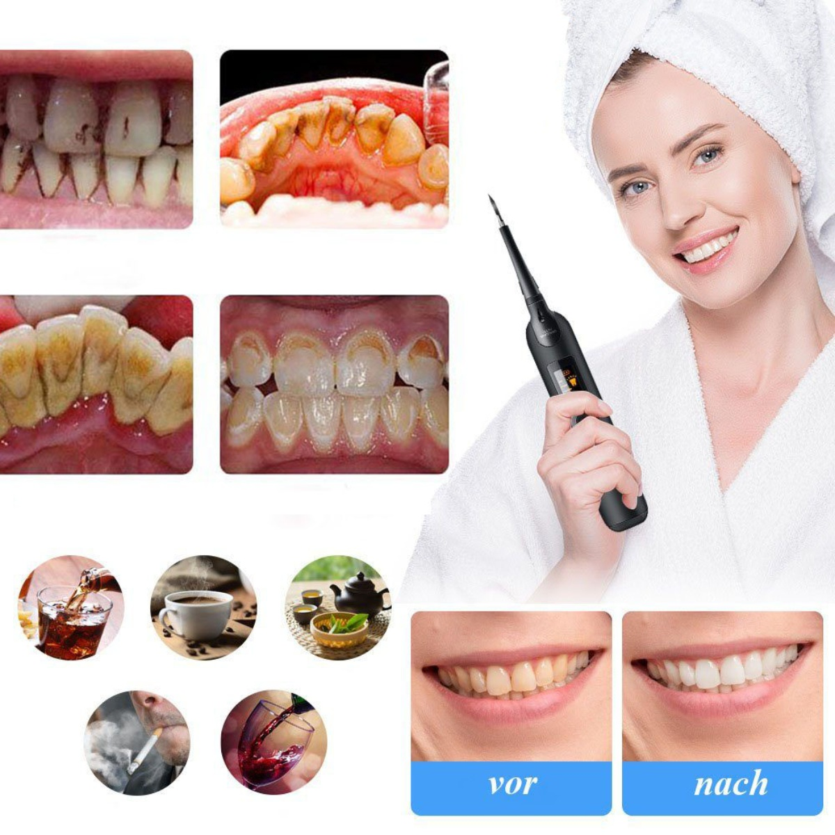 Zahnhygiene-Vergleich mit Zähnen vor und nach der Behandlung und Ursachen für Verfärbungen.