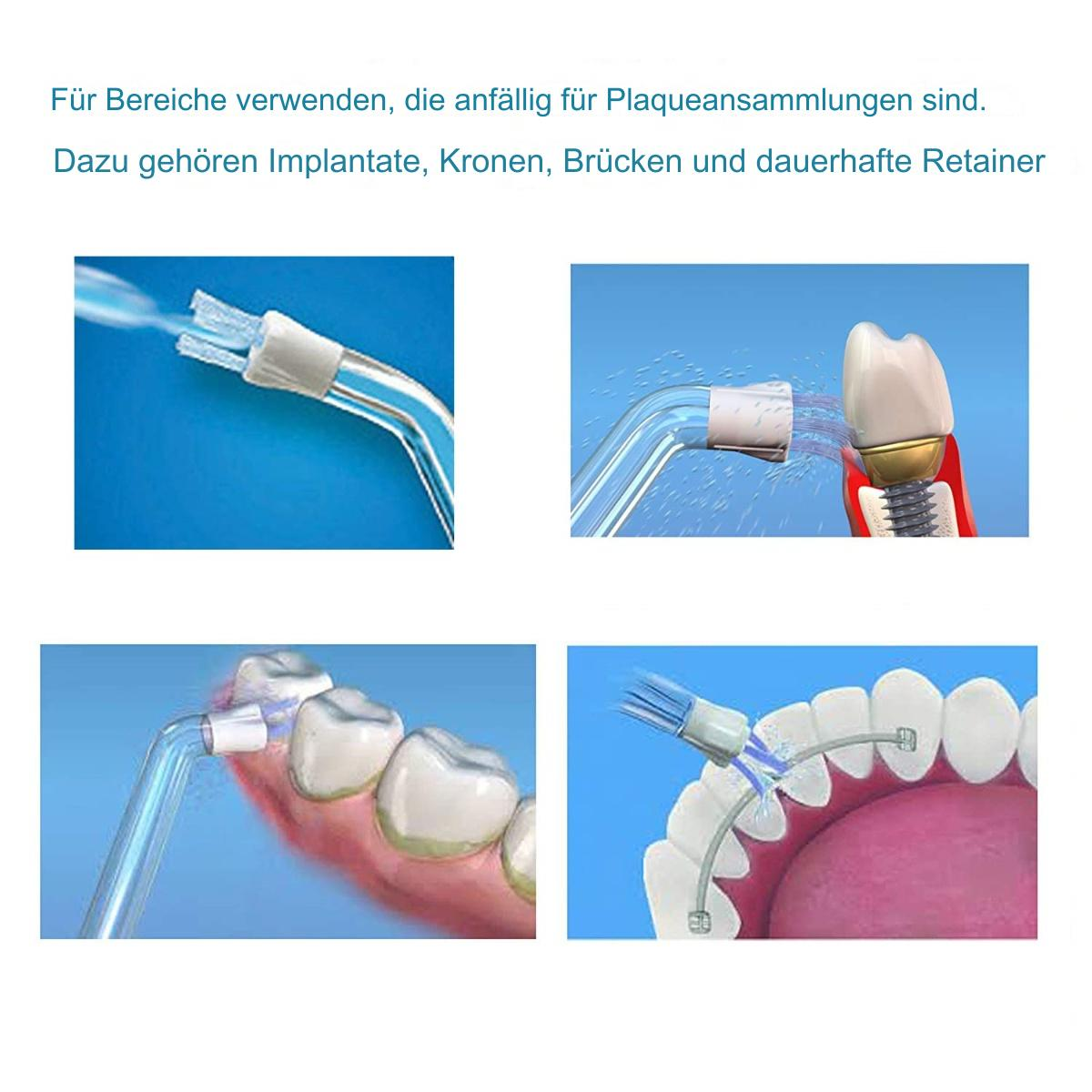 Vierteiliges Bild, das die Zahnreinigung mit einem Wasserflosser zeigt.