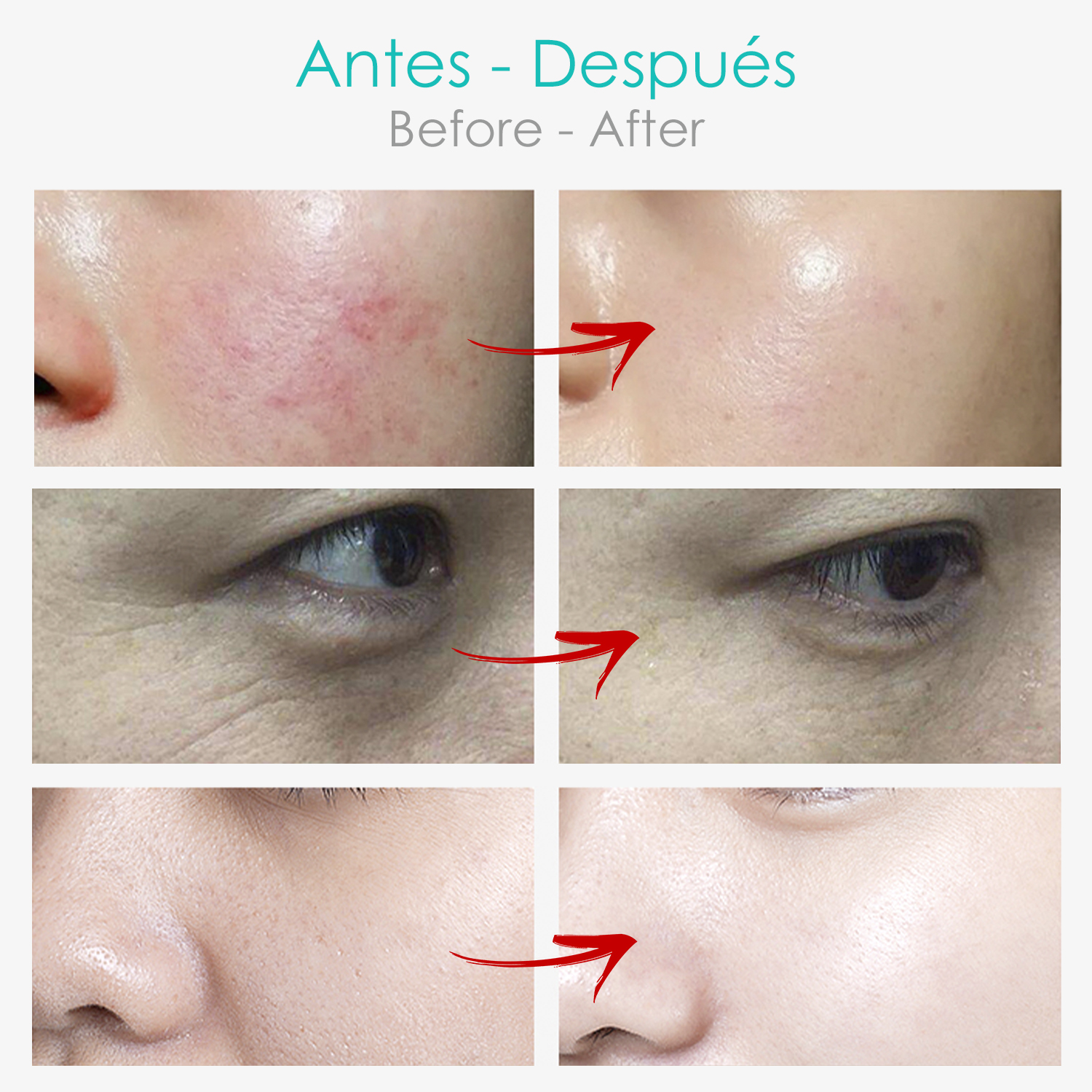 Imágenes del antes y el después de un rostro, mostrando la mejora de la piel.
