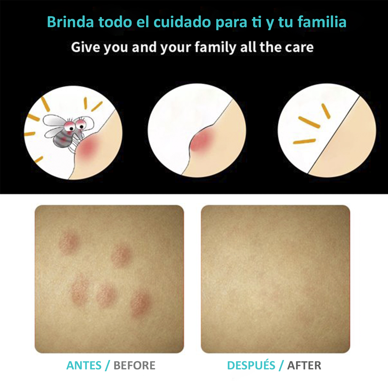 Diagramas muestran picaduras de mosquitos antes y después del tratamiento en la piel.