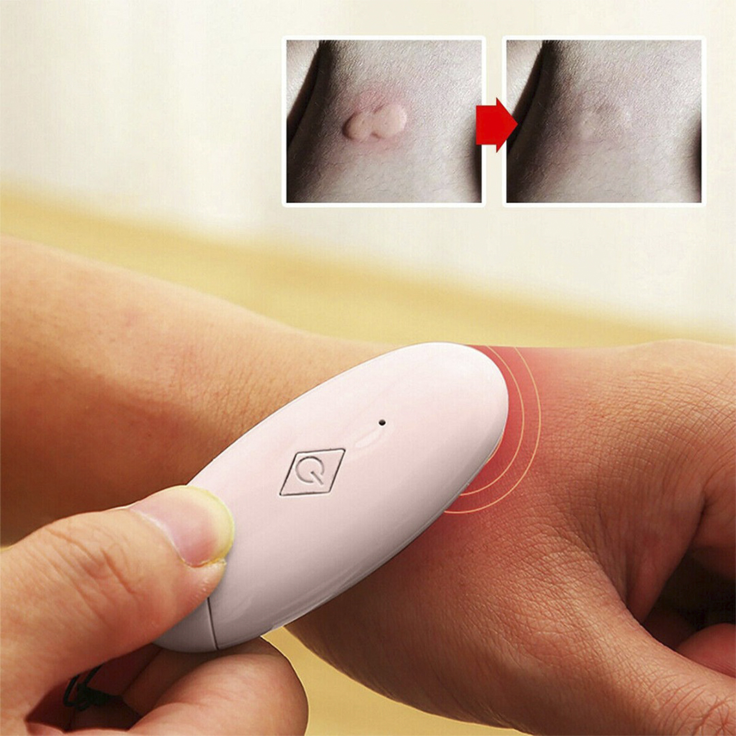 Un dispositivo en una muñeca e imágenes de piel antes y después.