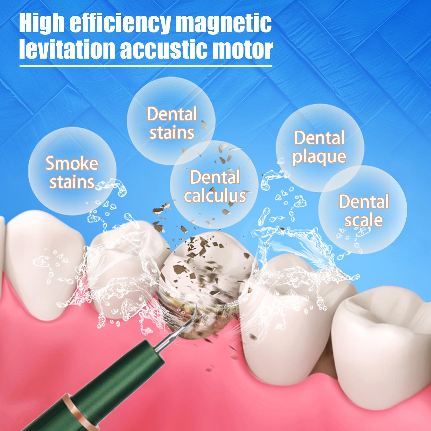 Ilustracja zębów z problemami dentystycznymi leczonych za pomocą narzędzia czyszczącego.