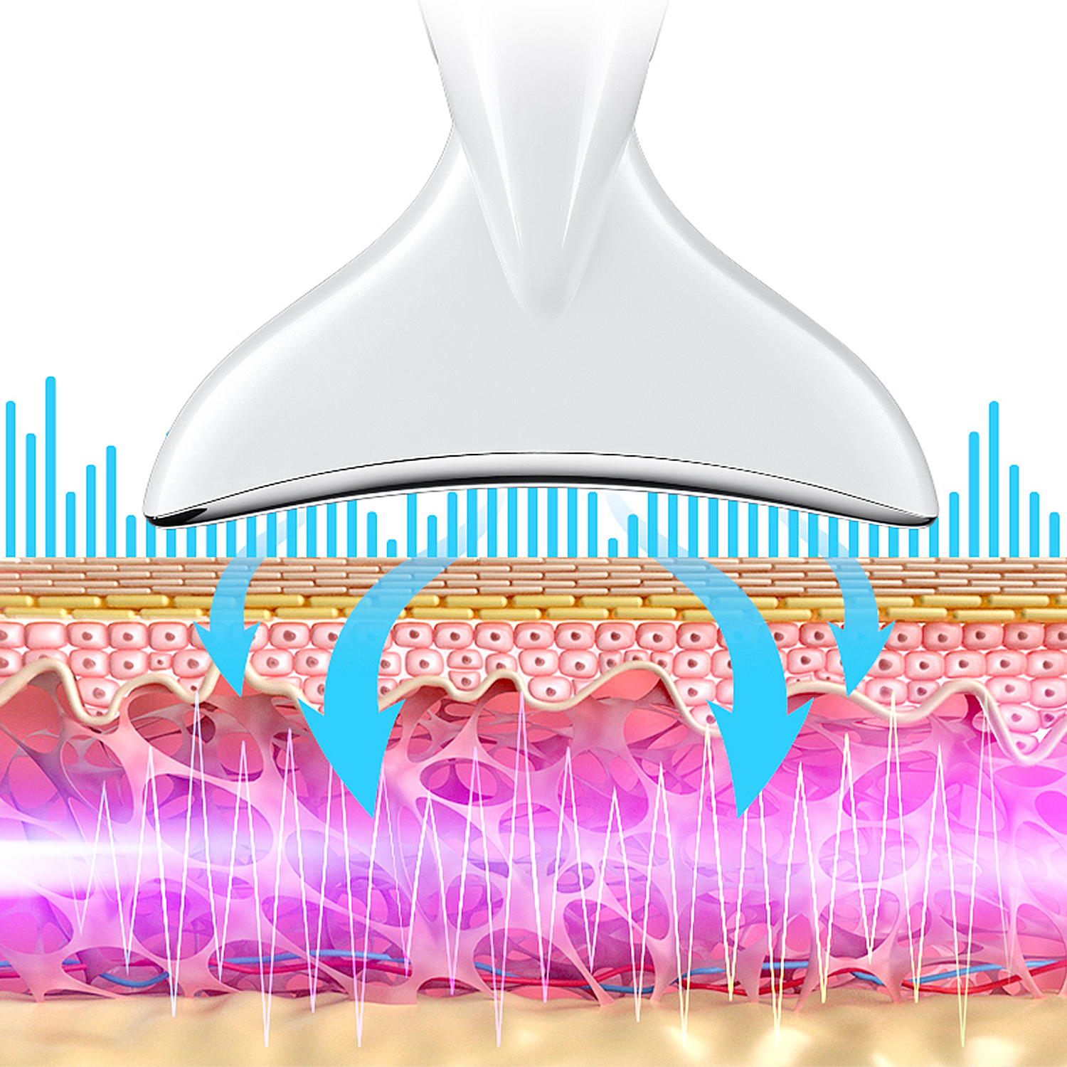 Dispositivo aplicando tratamiento a capas de piel con ondas de energía azules, estructura de la piel visible.