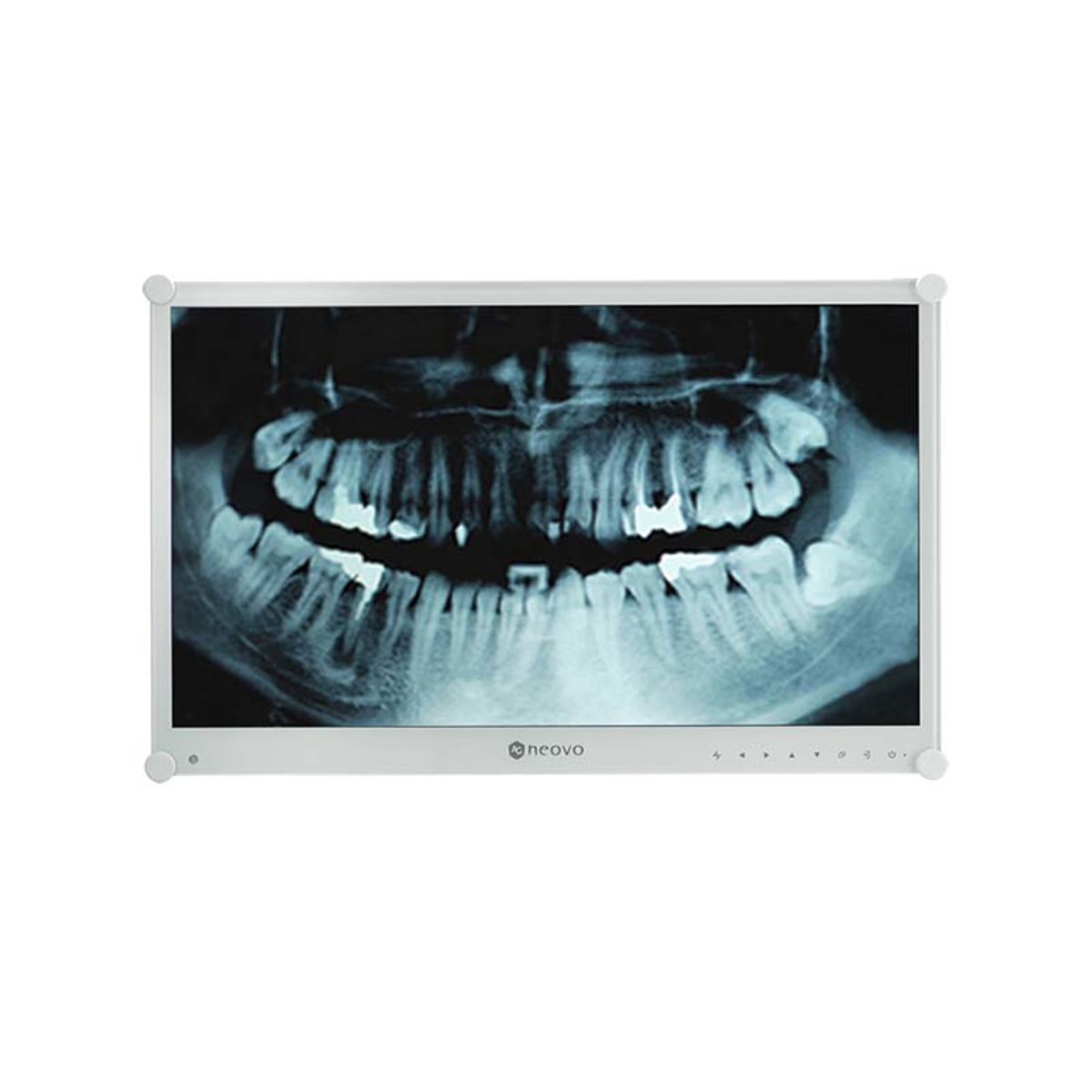 Radiografia dentale su uno schermo bianco. Mostra denti e mascella in bianco e nero. Una cornice bianca lo circonda.