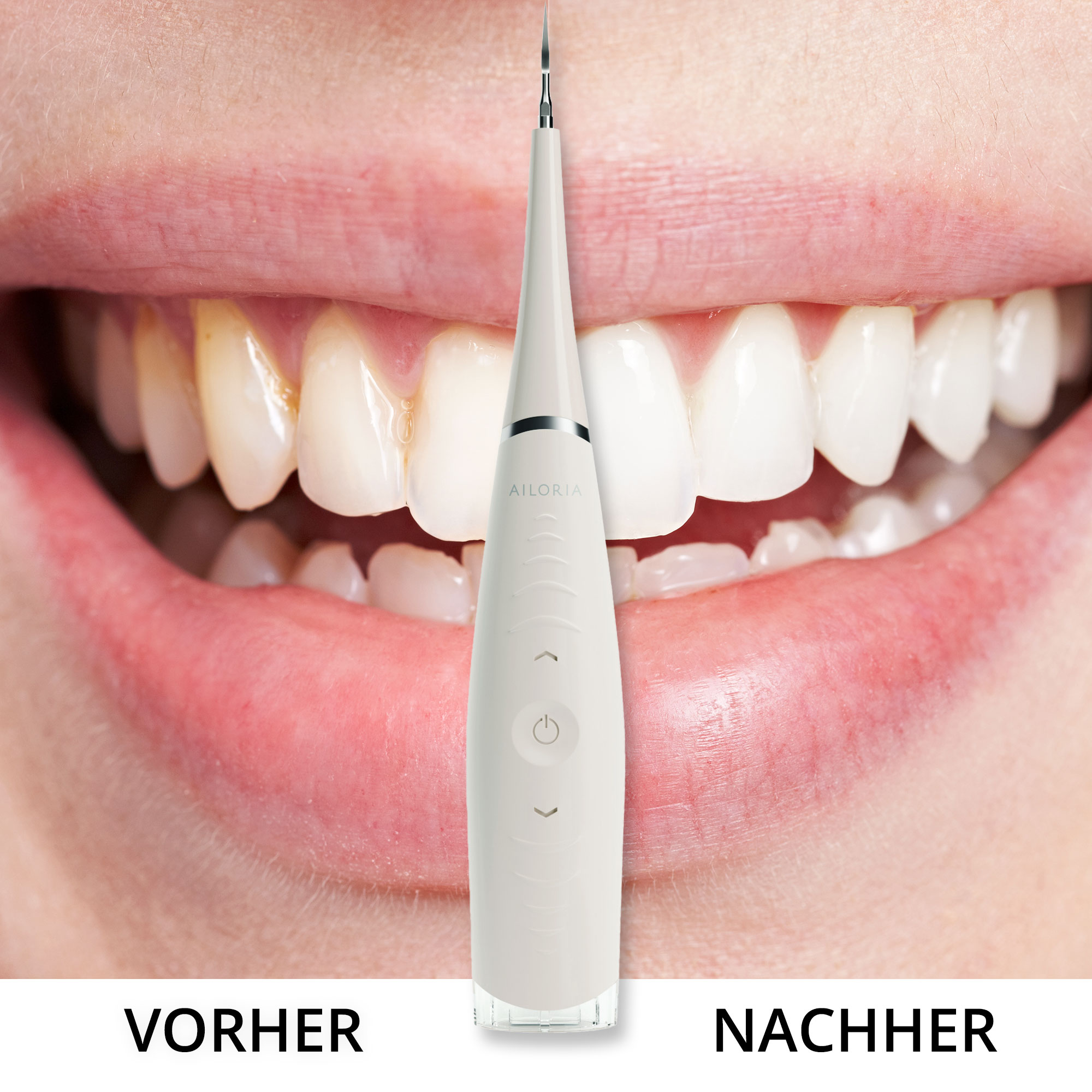 Zahnreinigung Vergleich: Vorher und Nachher. Ein Handgerät reinigt Zähne und zeigt ein helleres Lächeln.
