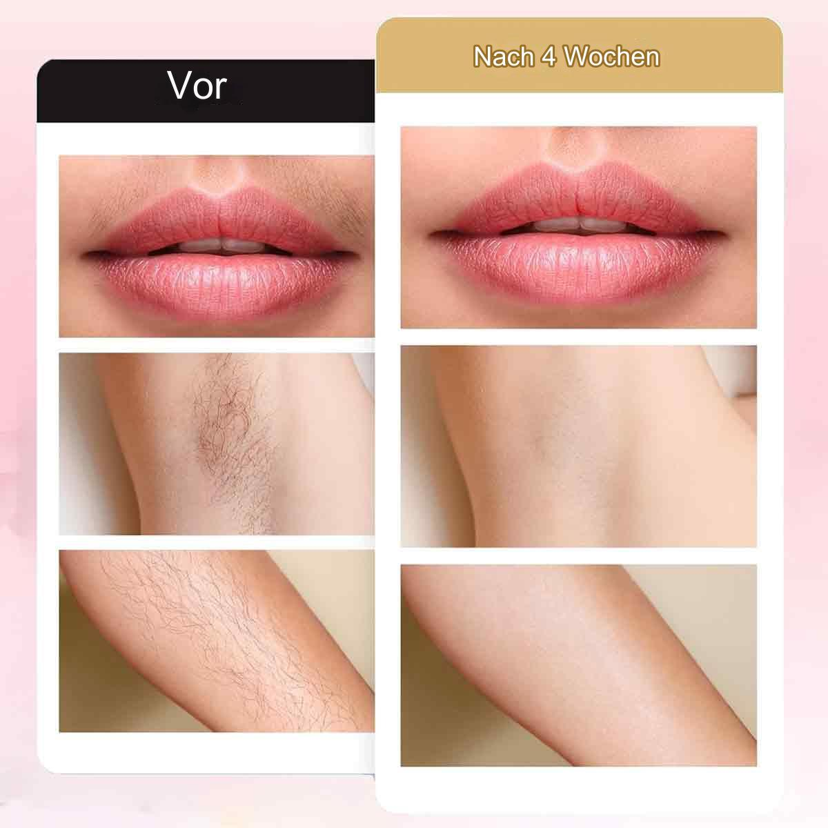 Geteiltes Bild zeigt Vorher-Nachher-Haarentfernung an Lippen, Achseln und Arm.