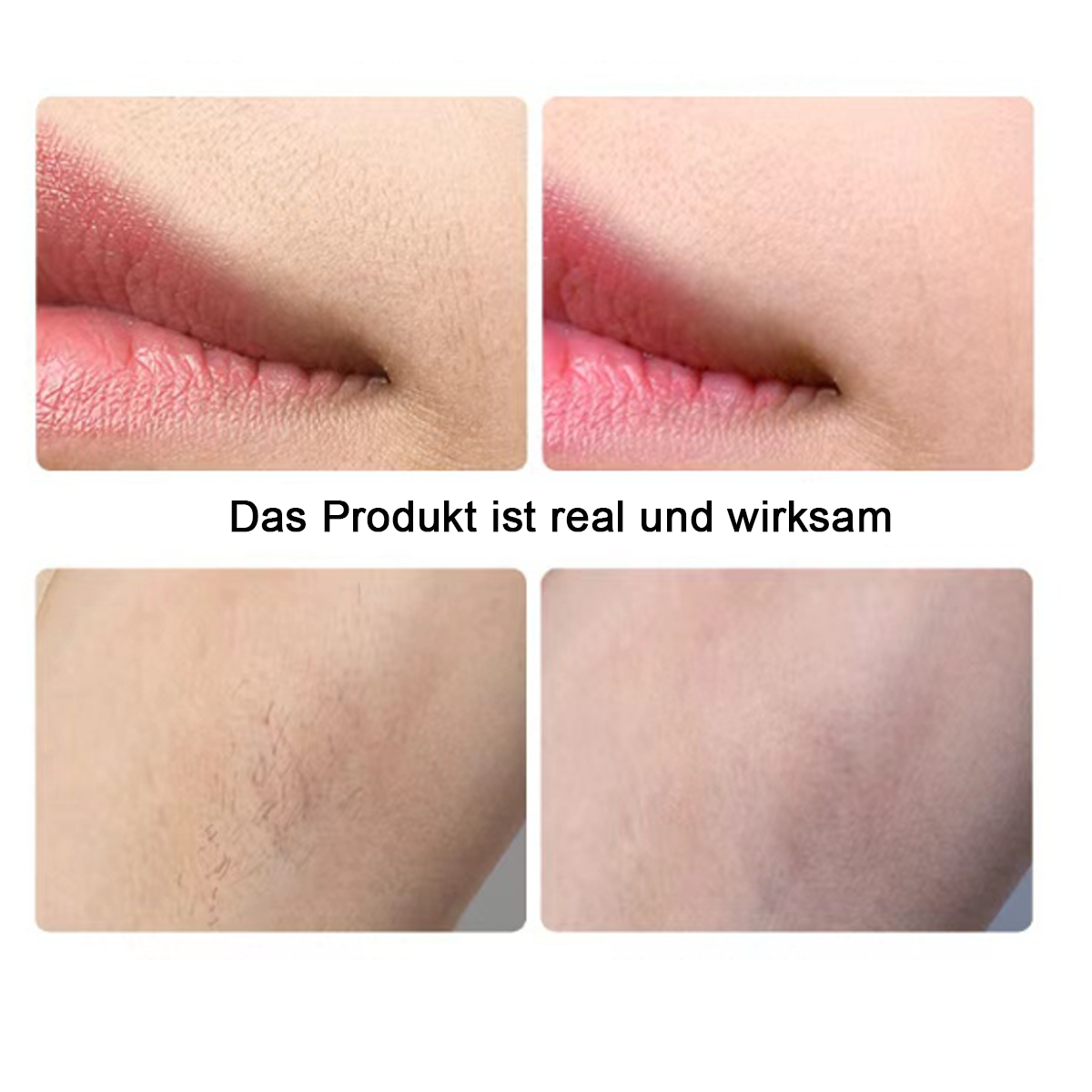 Bilder zeigen Vorher-Nachher-Haarentfernung an Lippen und Achseln. Text sagt: Das Produkt ist echt und wirksam.