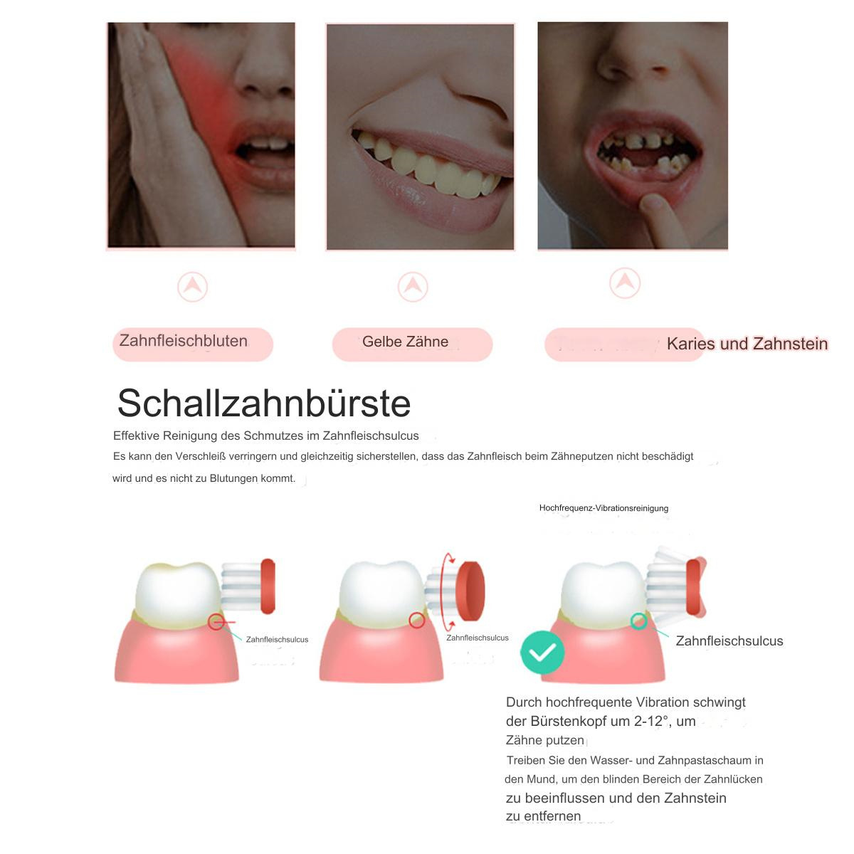 Diagramm von Zähnen mit Zahnfleischproblemen und einer Schallzahnbürste. Text auf Deutsch.