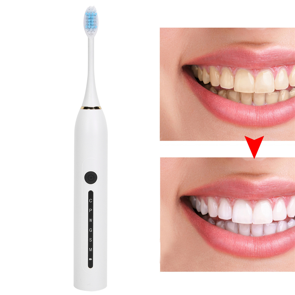 Elektrische Zahnbürste und Vergleich der Zähne vor und nach dem Bleaching.