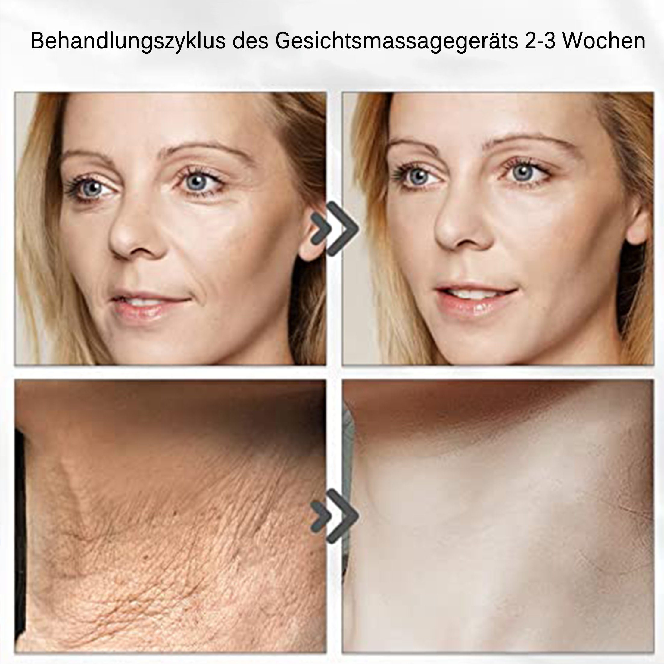 Vorher-Nachher-Fotos, die eine Verbesserung der Gesichts- und Halshaut zeigen. Die Bilder sind beschriftet.