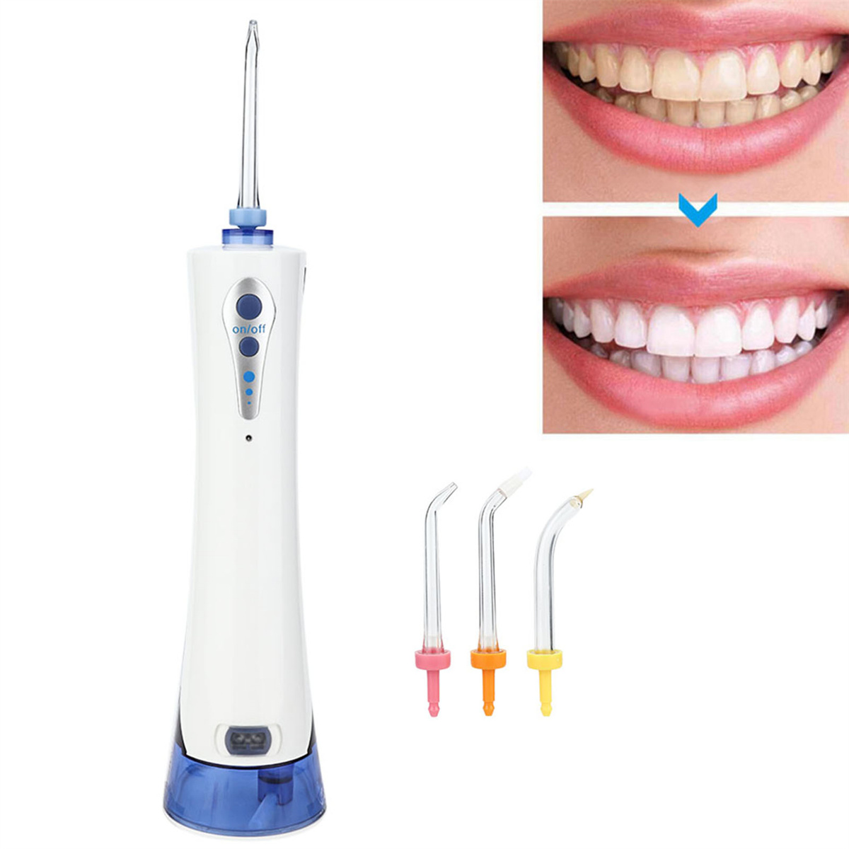 Ein weißer Wasser-Flosser mit drei verschiedenfarbigen Spitzen und einem Vorher-/Nachher-Zahnaufhellungsvergleich.