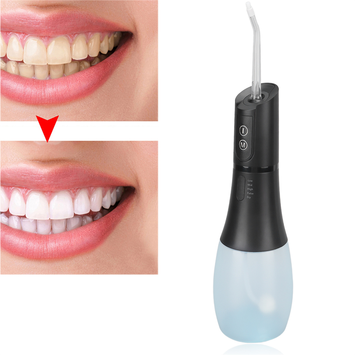 Vorher/Nachher-Zahnreinigung mit Wasserflosser. Wasserflosser rechts.