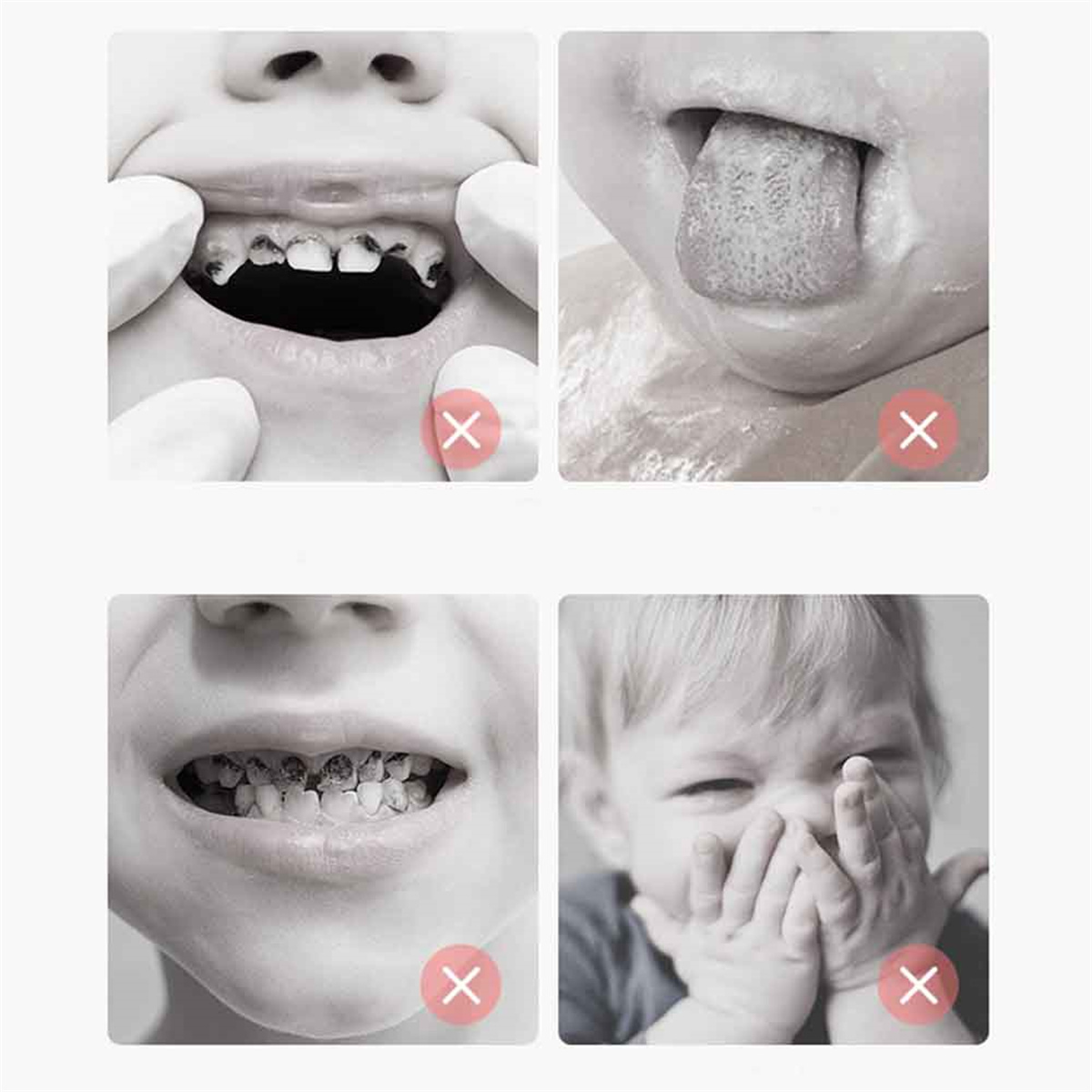 Bilder, die schlechte Zähne und die Zungengesundheit eines Kindes zeigen. Kreuzmarkierungen weisen auf Probleme hin.
