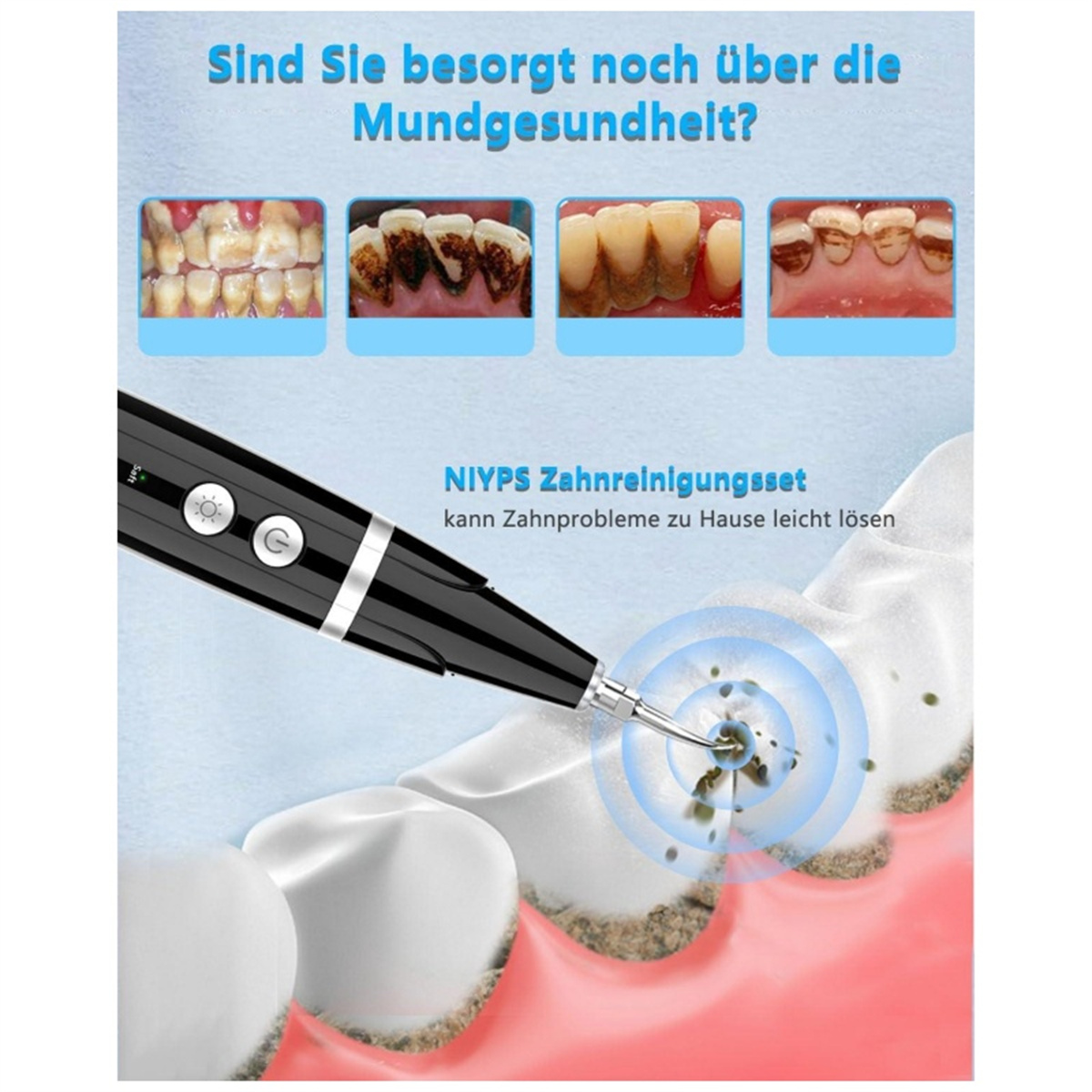 Zahnreinigungswerkzeug mit Illustrationen von Zähnen und einem Diagramm des Reinigungsprozesses.