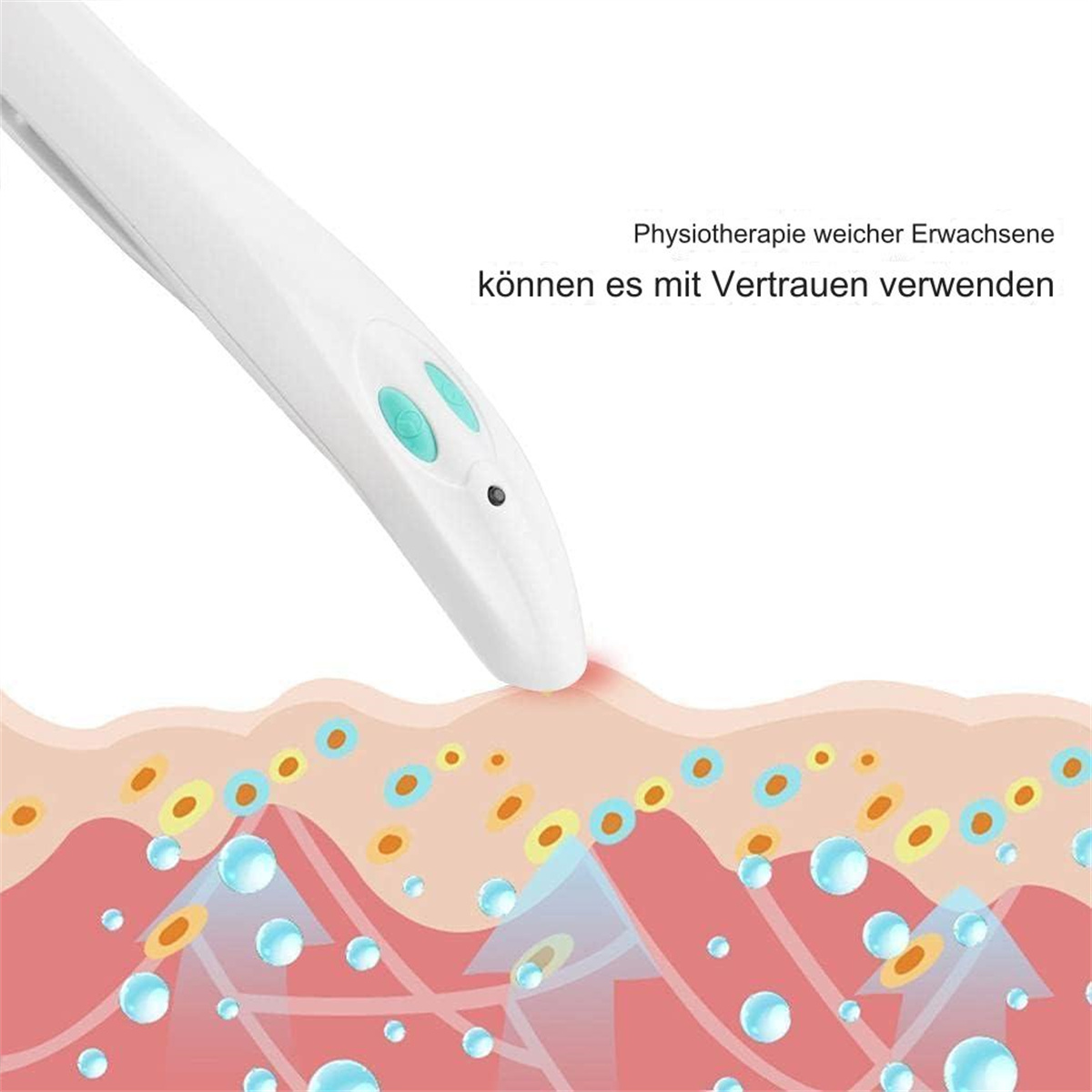 Weißes medizinisches Gerät berührt Haut mit visueller Darstellung von Gewebe und Blasen.