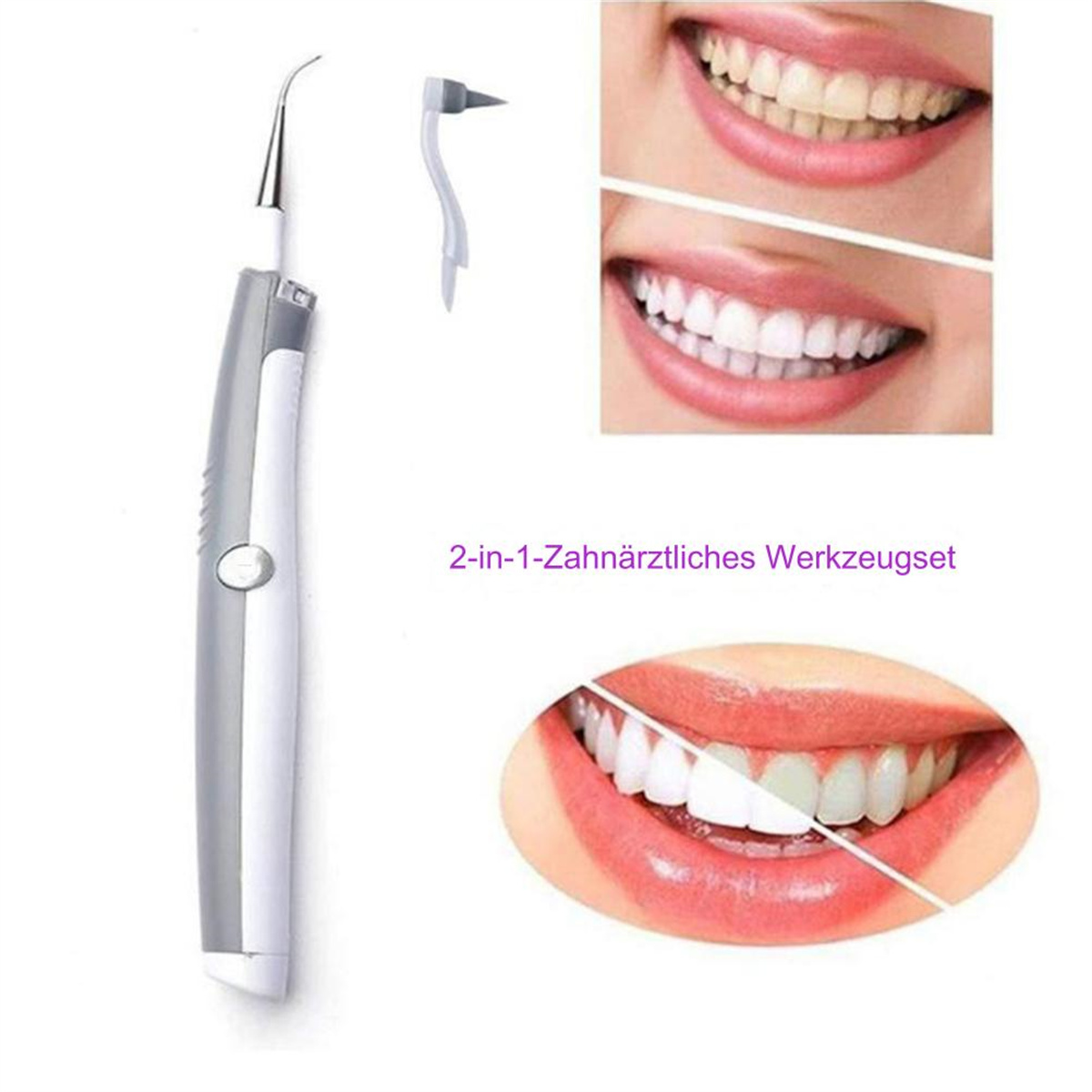 Zahnreinigungswerkzeug mit Vorher-Nachher-Ergebnissen der Zahnaufhellung.