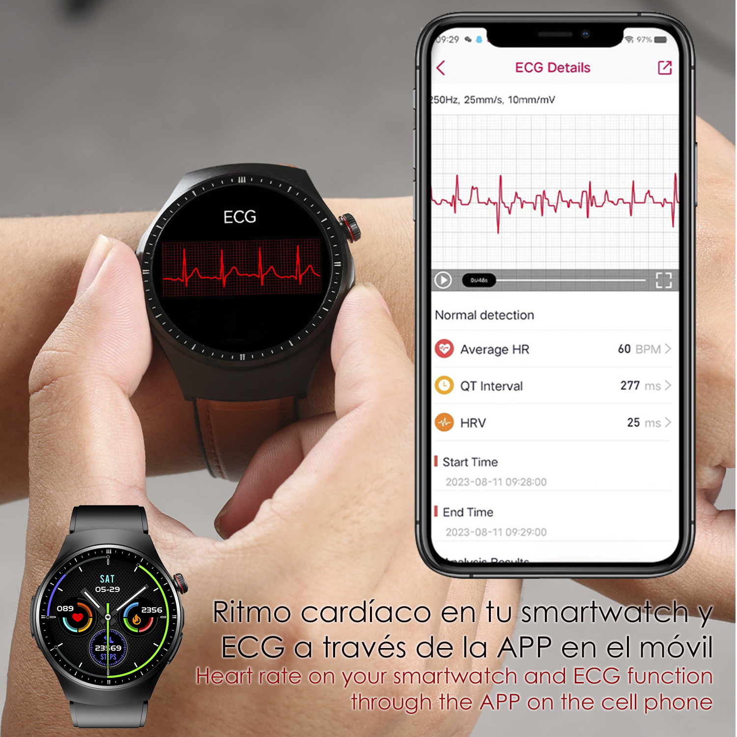 Smartwatch e schermo del telefono che mostrano i dati ECG. Grafico della frequenza cardiaca rosso. Mani, orologio nero.