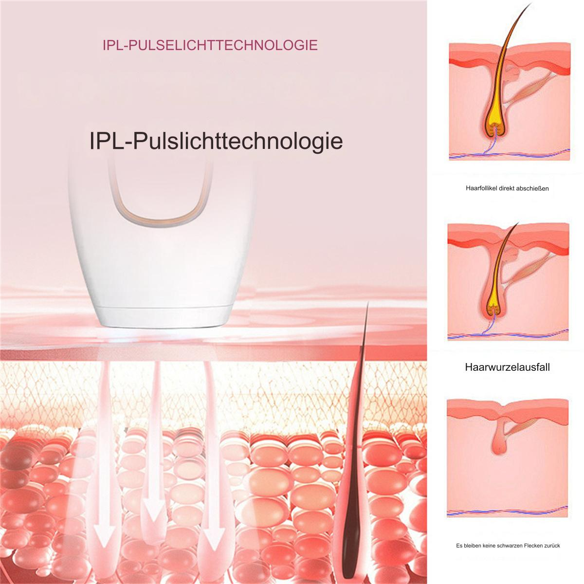 Diagramm der IPL-Haarentfernung. Zeigt Gerät und Hautschichten mit Haarfollikeldiagrammen; Text auf Deutsch.