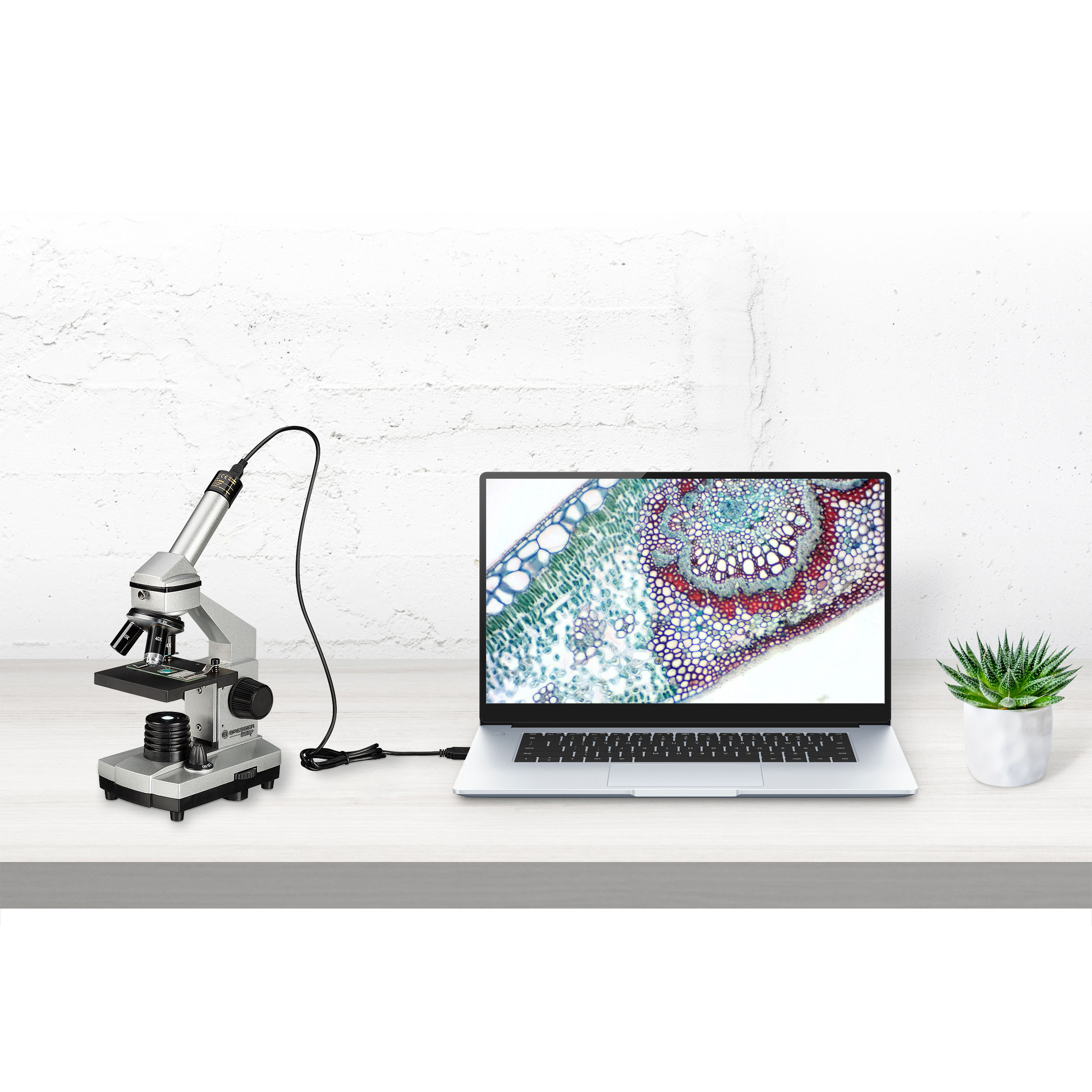 Mikroskop mit Laptop verbunden. Der Laptop zeigt ein Bild einer Pflanzenzelle.