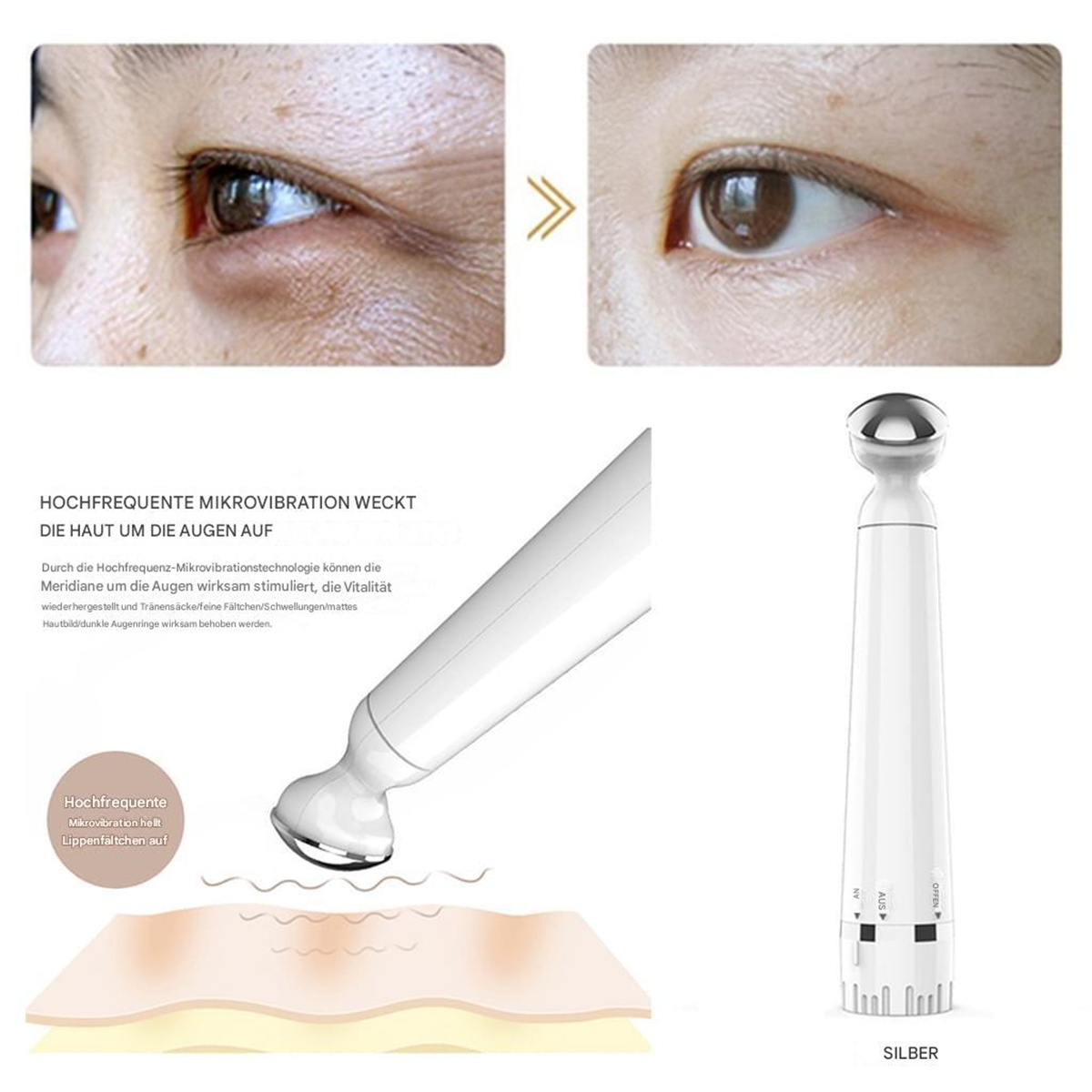 Nahaufnahme von Augen vor und nach der Behandlung mit einem Mikrovibrationsgerät.