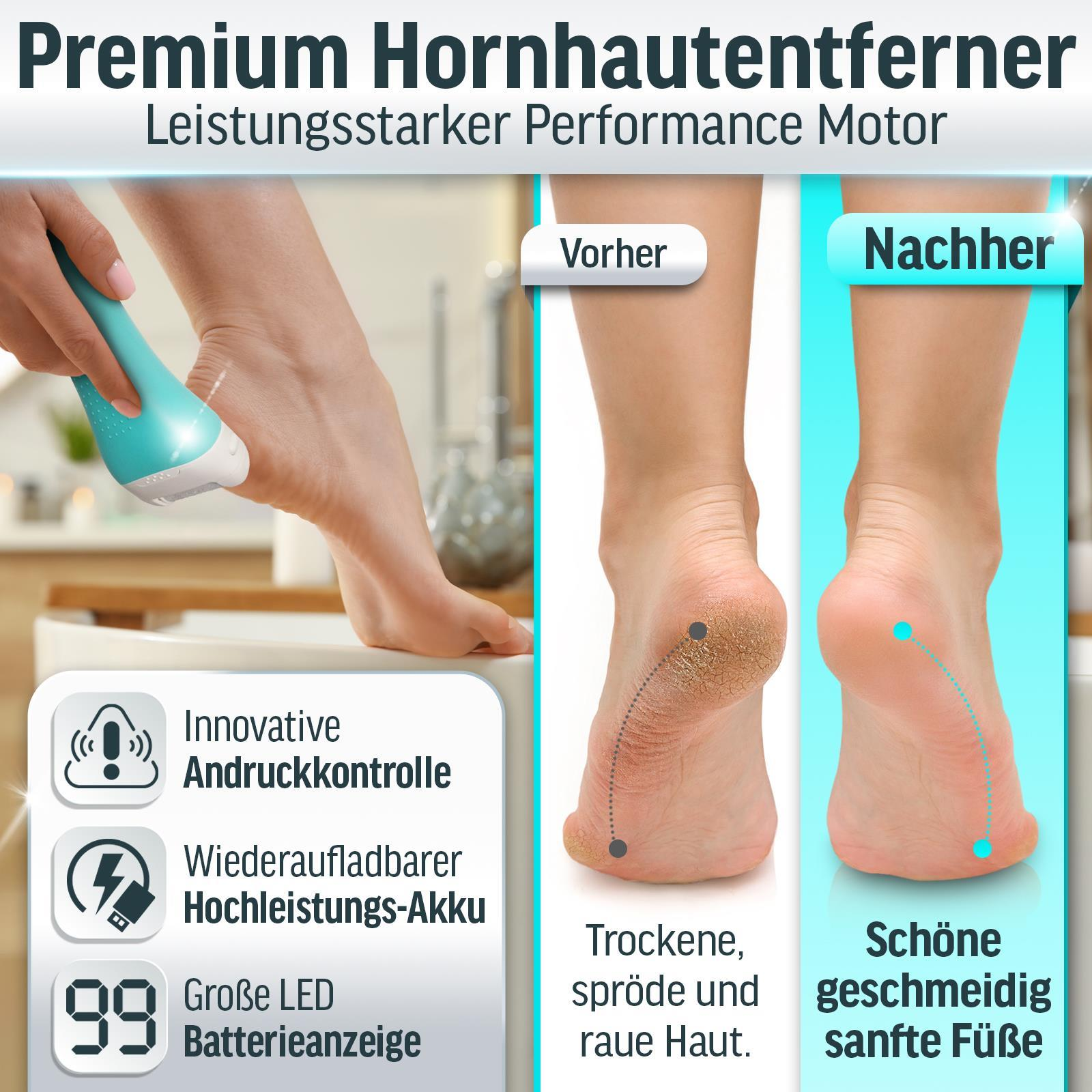 Fuß zeigt Vorher-Nachher-Hautbehandlung mit einem Fußpflegegerät. Der Nachher-Fuß ist glatt.