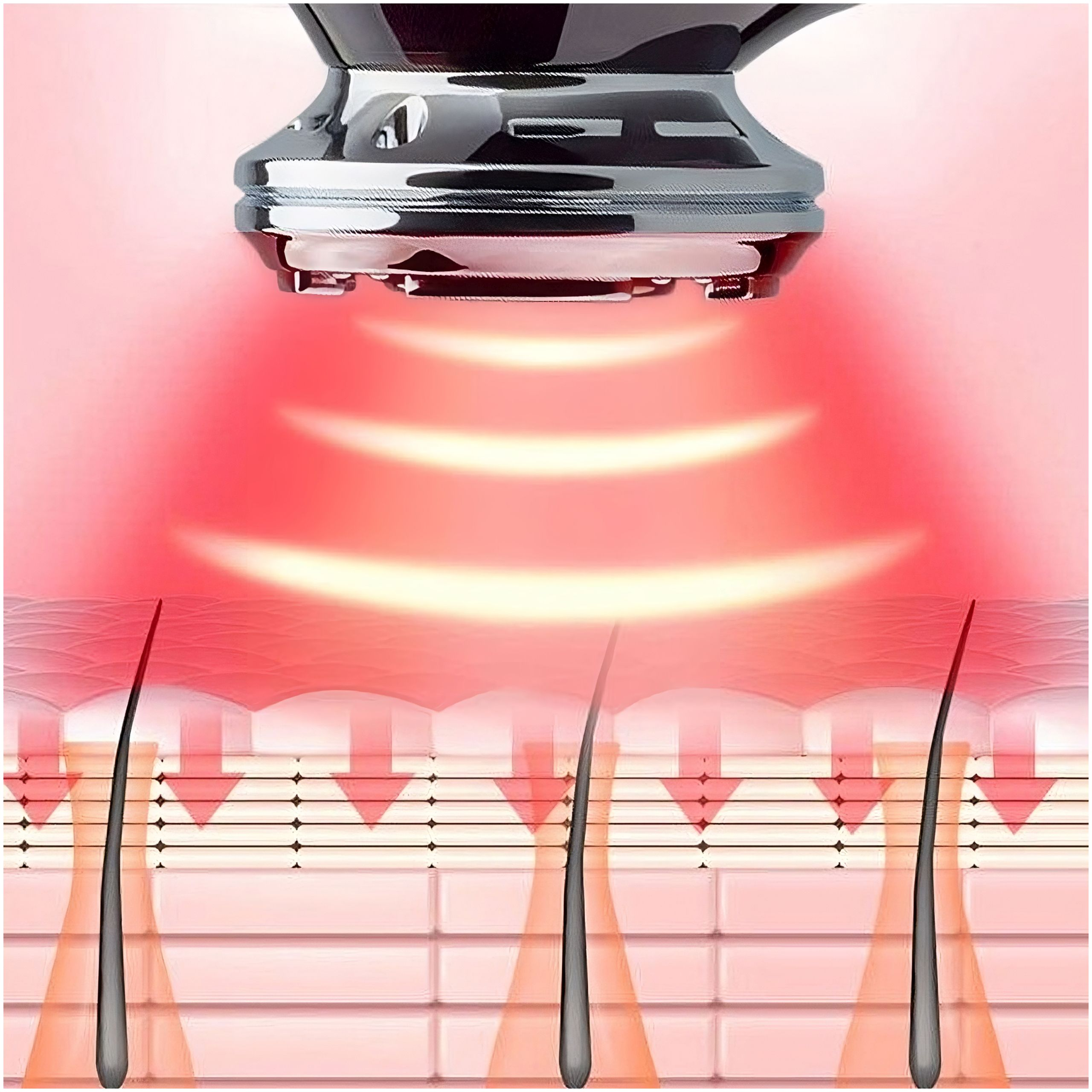 Rotlichttherapiegerät über Haut mit Haarfollikeln. Pfeile zeigen das Eindringen von Licht.