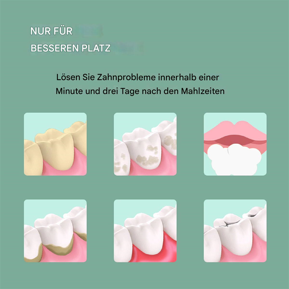 Illustrationen von Zähnen. Zeigt Vorher-Nachher-Effekte eines Produkts. Zähne mit Flecken zur Zahnreinigung.
