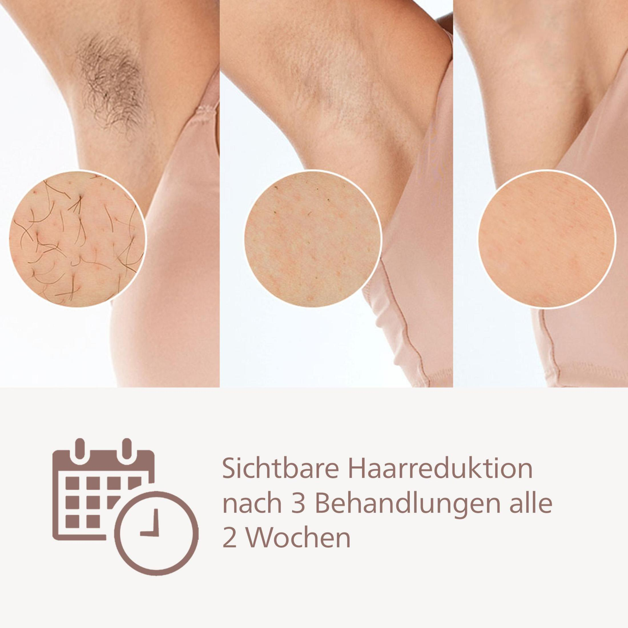 Trzy pachy z różnymi etapami usuwania włosów i ikoną kalendarza.