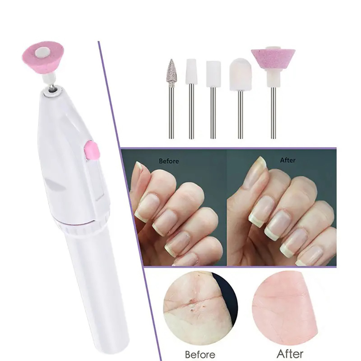 Taladro de uñas con accesorios e imágenes de uñas y piel antes/después. Fondo blanco.