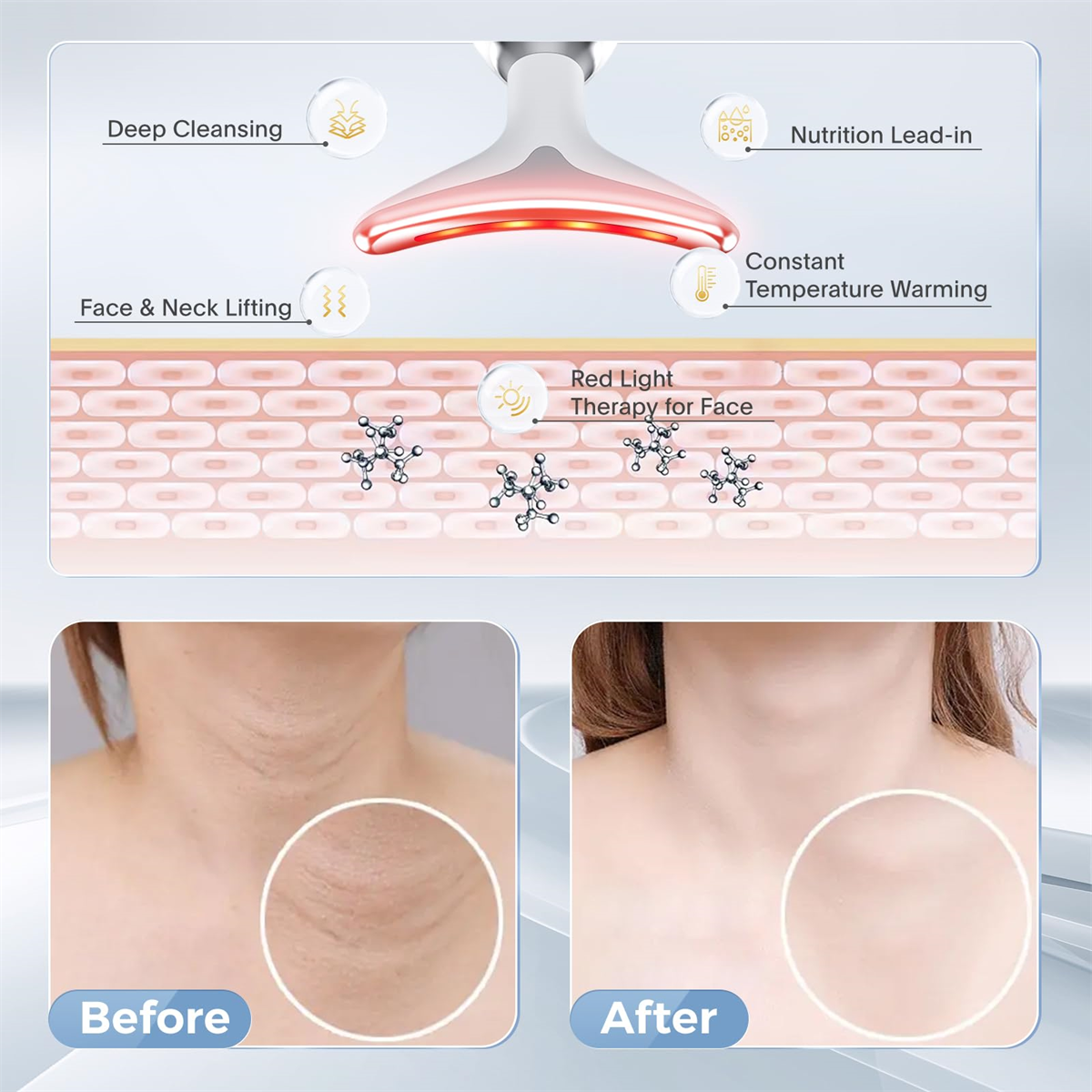 Diagramm zeigt ein Gesichts- und Nackengerät mit Rotlichttherapie. Vorher-Nachher-Bilder zeigen den Effekt.