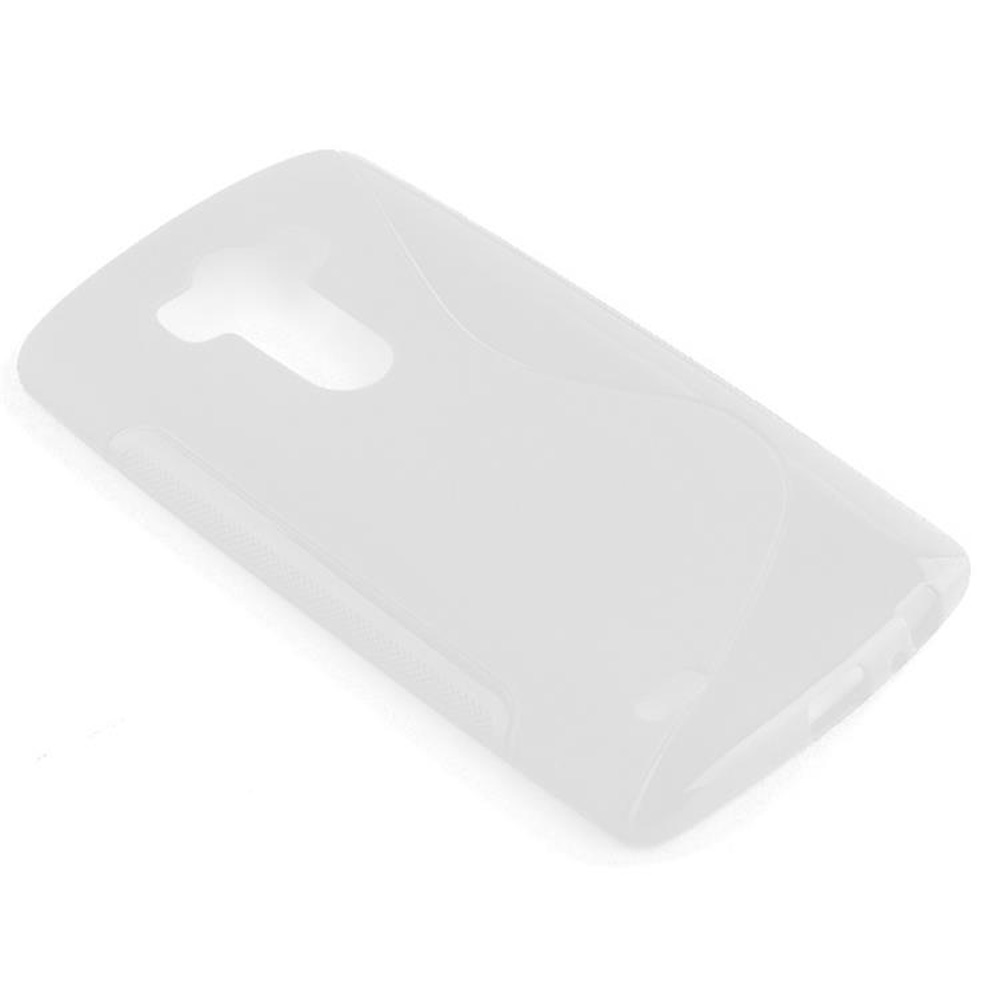 Funda de teléfono blanca. La funda es de plástico. El teléfono no es visible.
