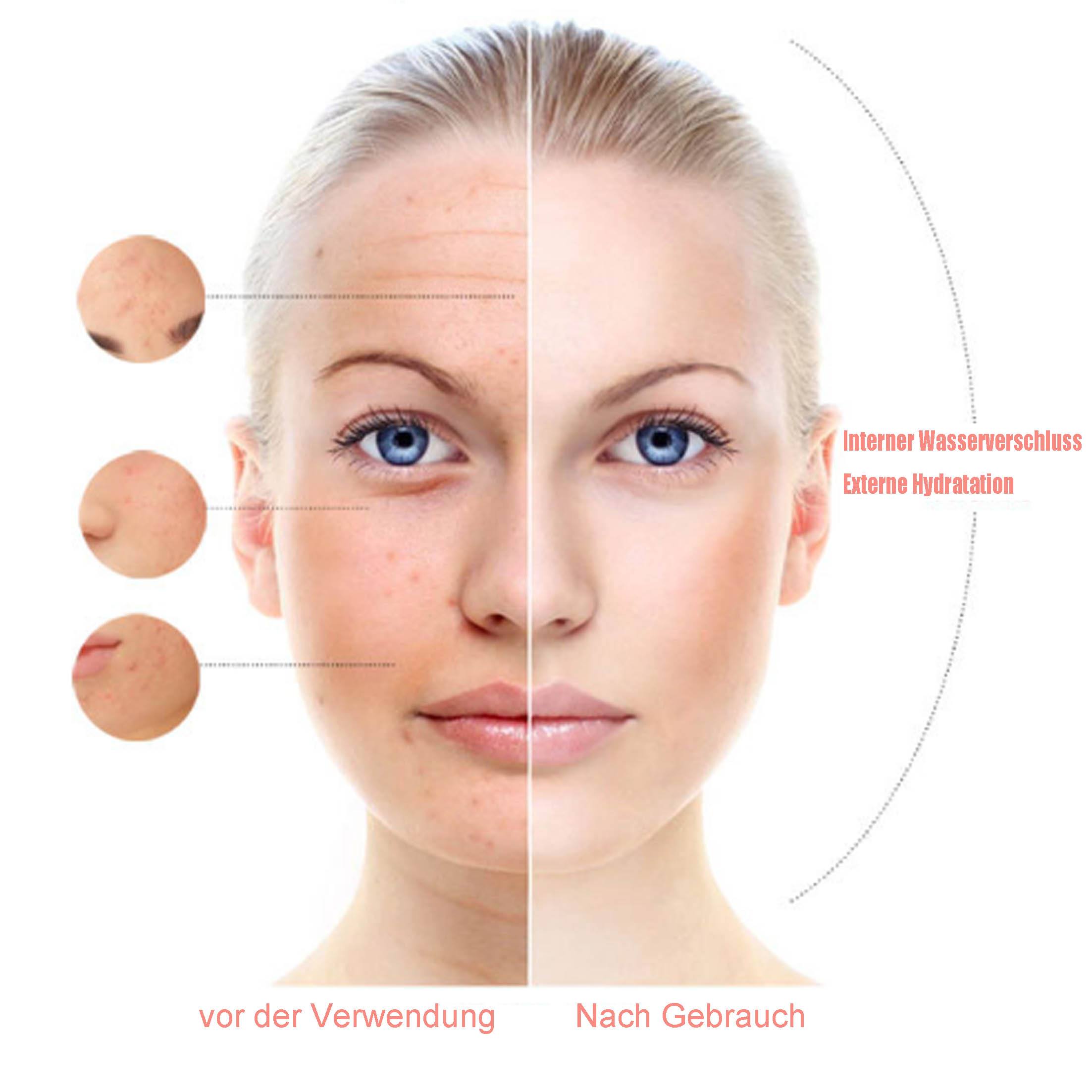 Gespaltenes Gesicht, das Vorher-Nachher-Behandlung zeigt. Klare Haut rechts.