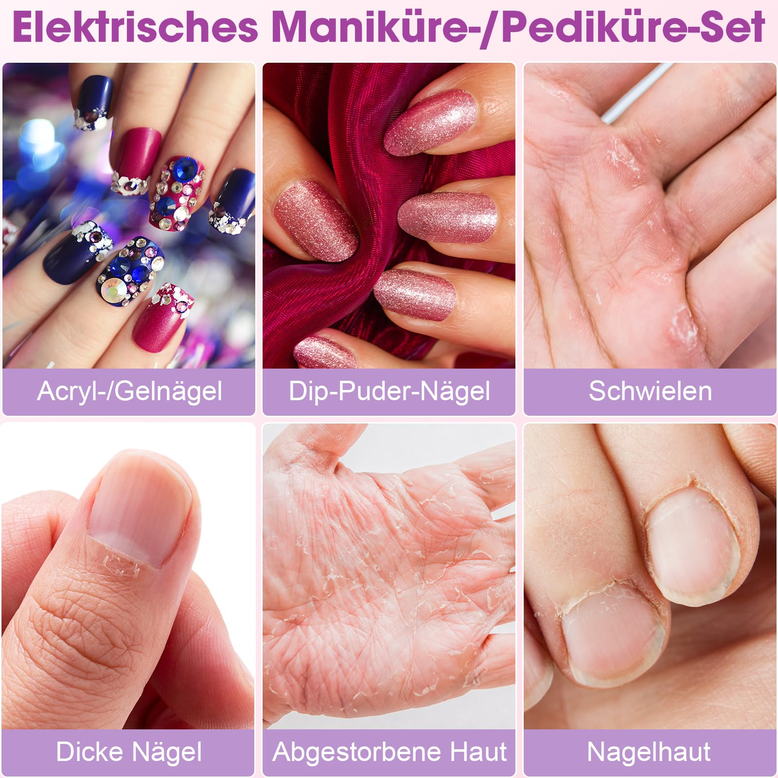 Nahaufnahme von Nägeln mit verschiedenen Behandlungen. Text: Acrylnägel, Dip-Puder-Nägel, Dicke Nägel, abgestorbene Haut.