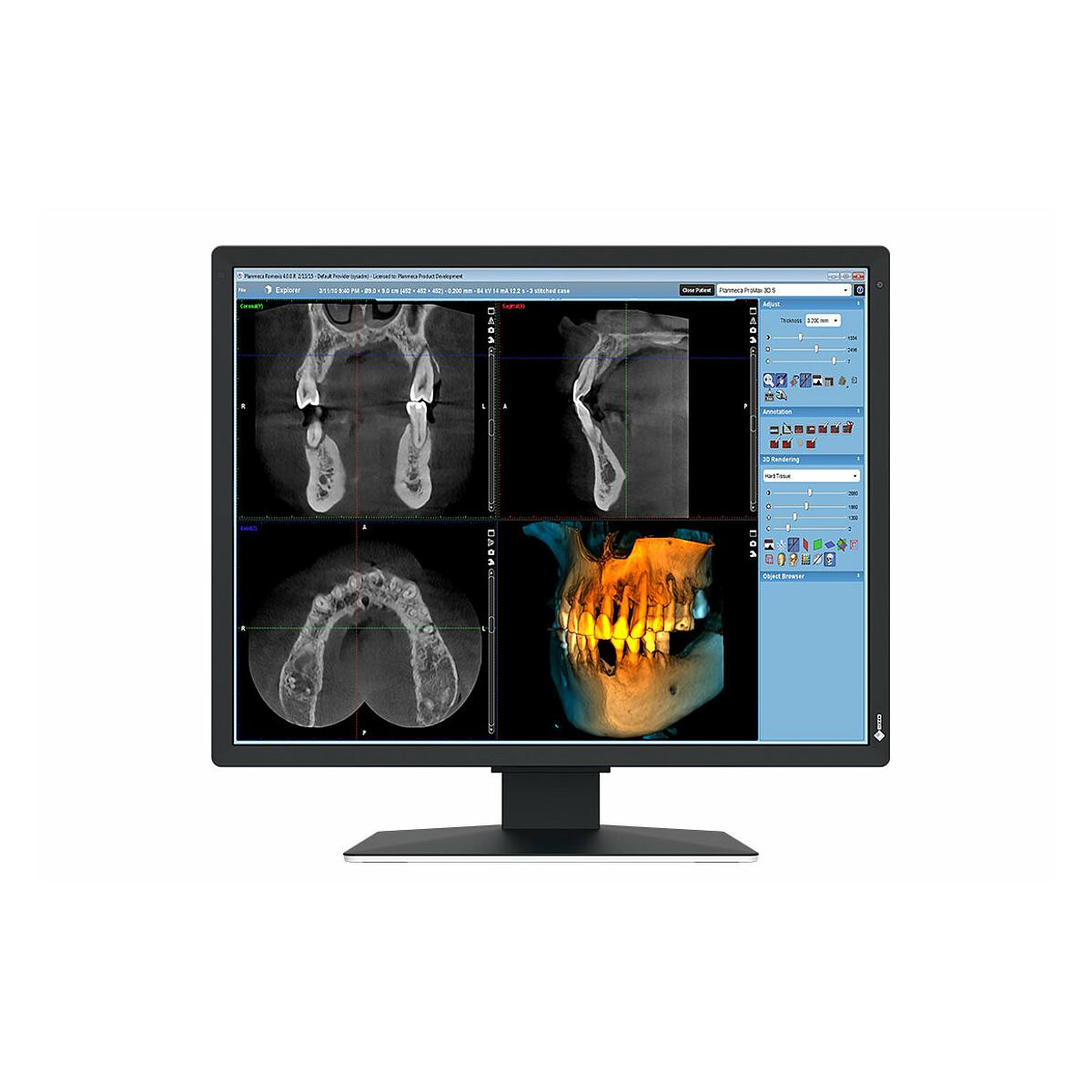 Monitor del computer che mostra immagini radiografiche dentali. Sono visibili più viste sullo schermo.