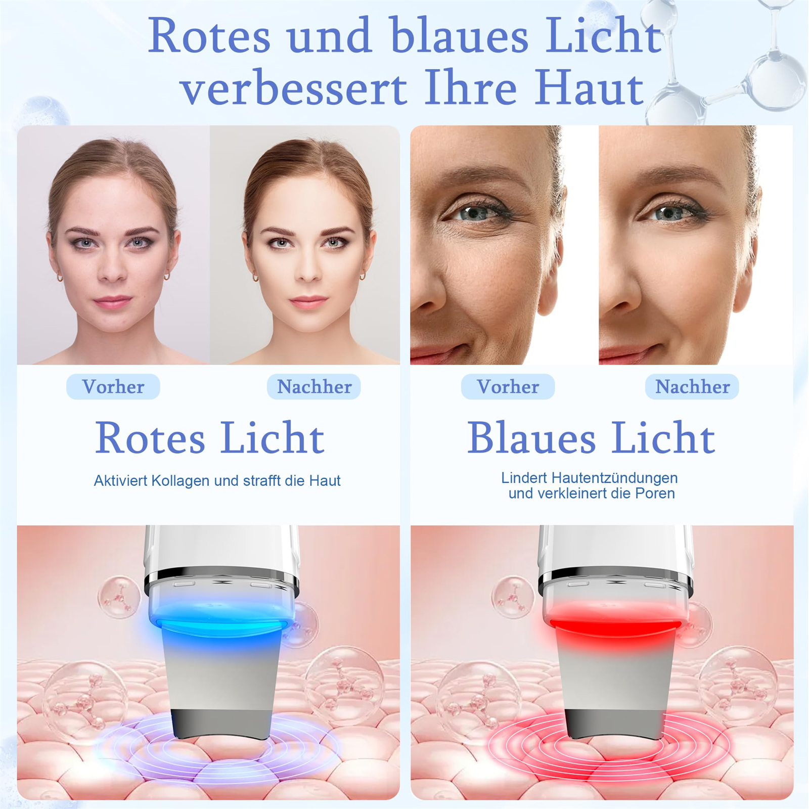 Bilder, die Rot- und Blaulichteffekte auf der Haut zeigen, vorher und nachher.