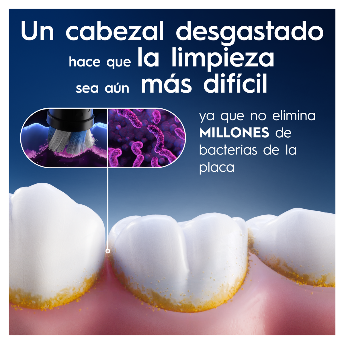 L'immagine mostra batteri e denti sporchi, testo sulla pulizia e la rimozione della placca.