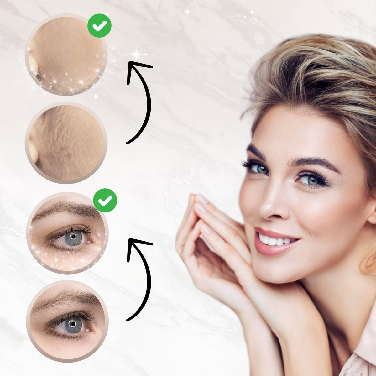 A woman smiling, with images showing skin improvement: before and after images of eyes and skin.