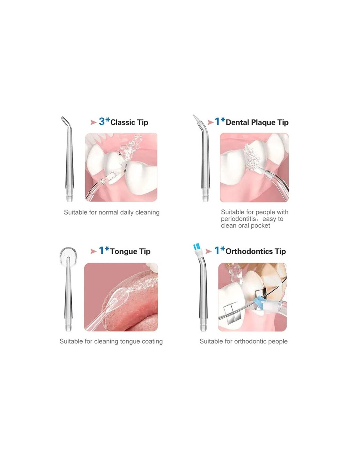 Diagrama de cuatro puntas de limpieza dental: clásica, placa dental, lengua y ortodoncia.