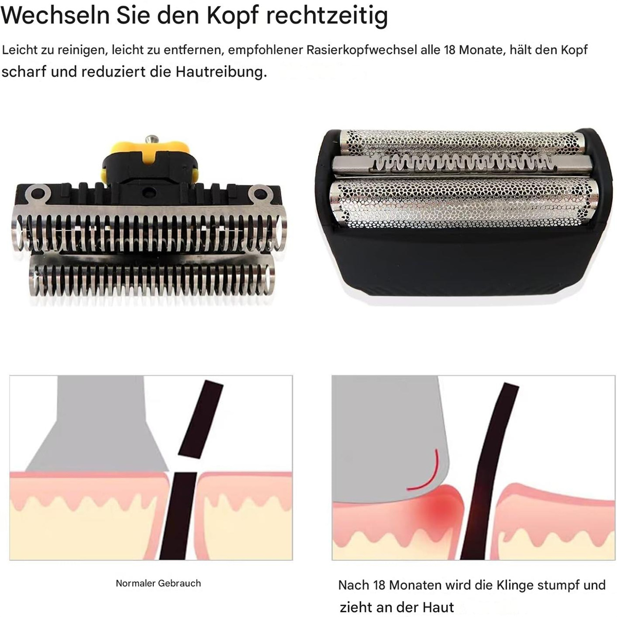 Nahaufnahme eines Rasiererkopfes und ein Diagramm, das die Auswirkungen nach 18 Monaten zeigt.