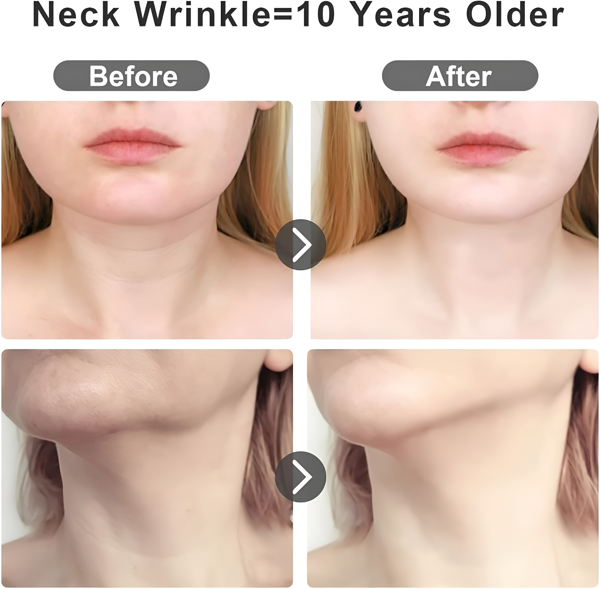 Vorher-Nachher-Fotos, die Halsfalten vergleichen, was Anti-Aging-Effekte suggeriert.