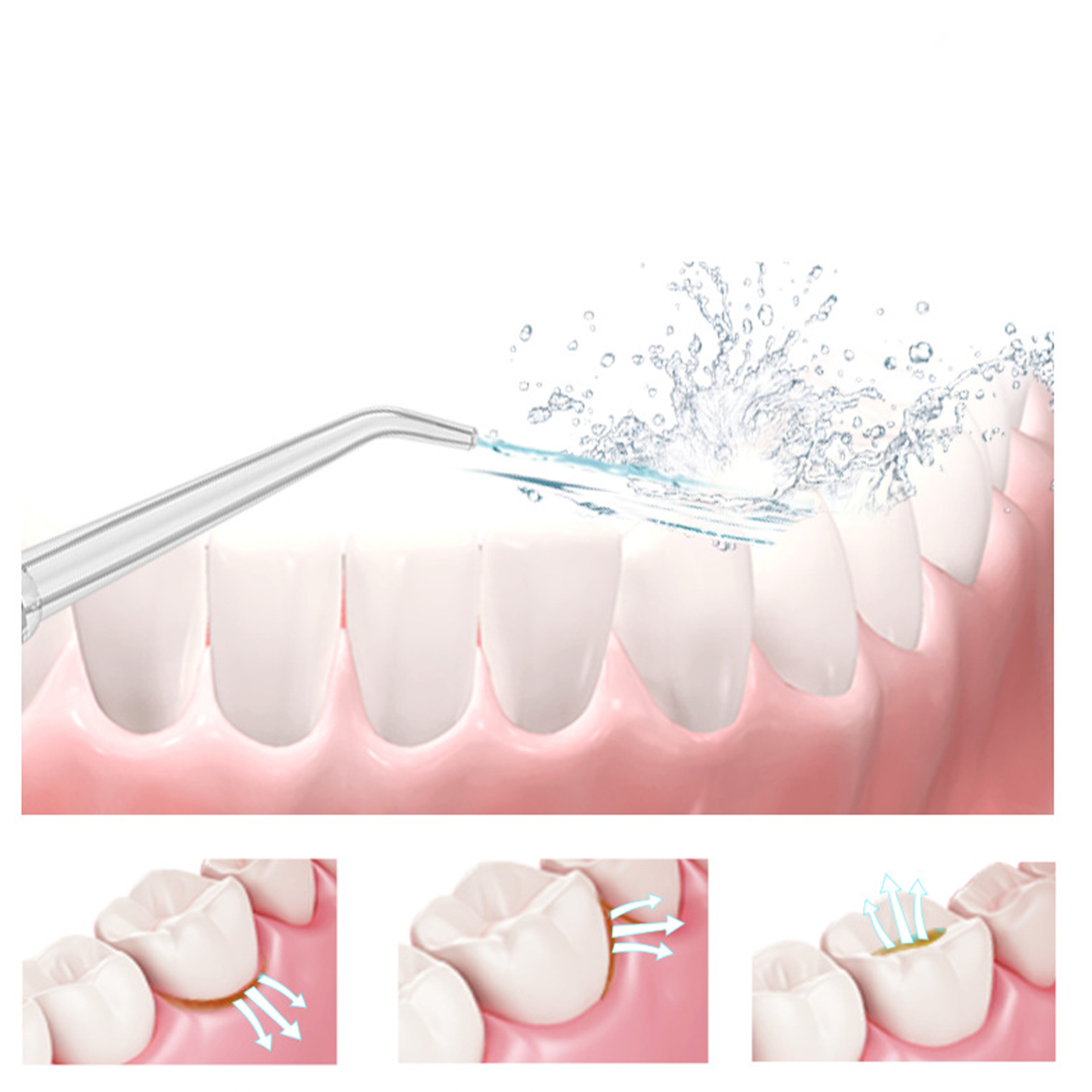 Ein Wasser-Flosser, der Wasser auf Zähne sprüht, mit Diagrammen, die den Reinigungsprozess veranschaulichen.