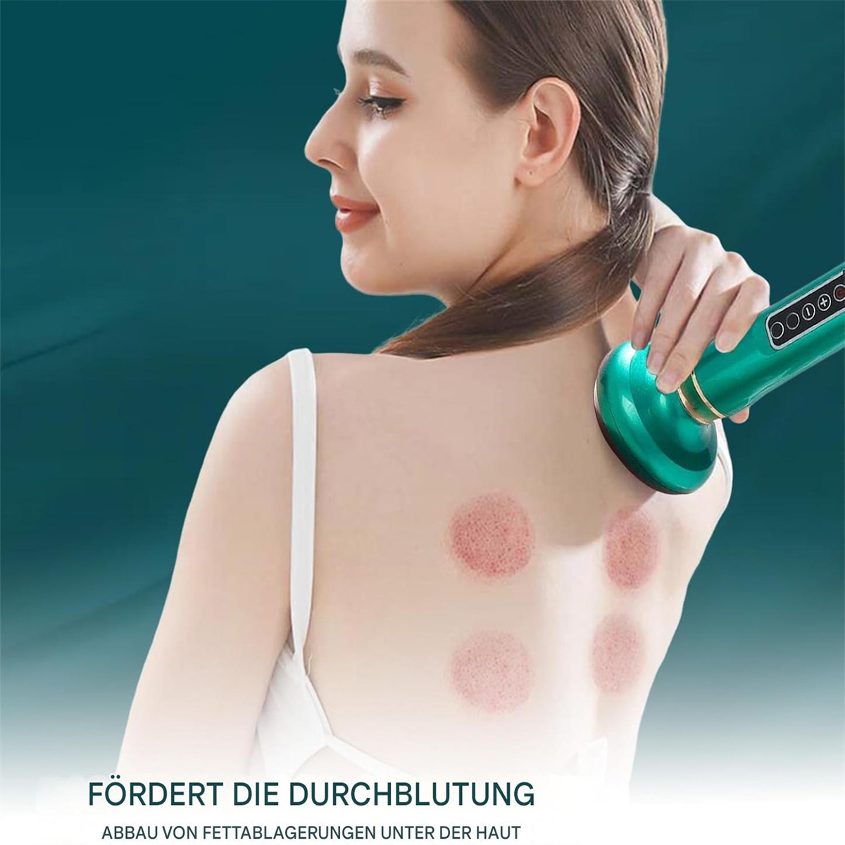 Frau mit Massagegerät auf dem Rücken, mit roten Flecken vom Schröpfen.
