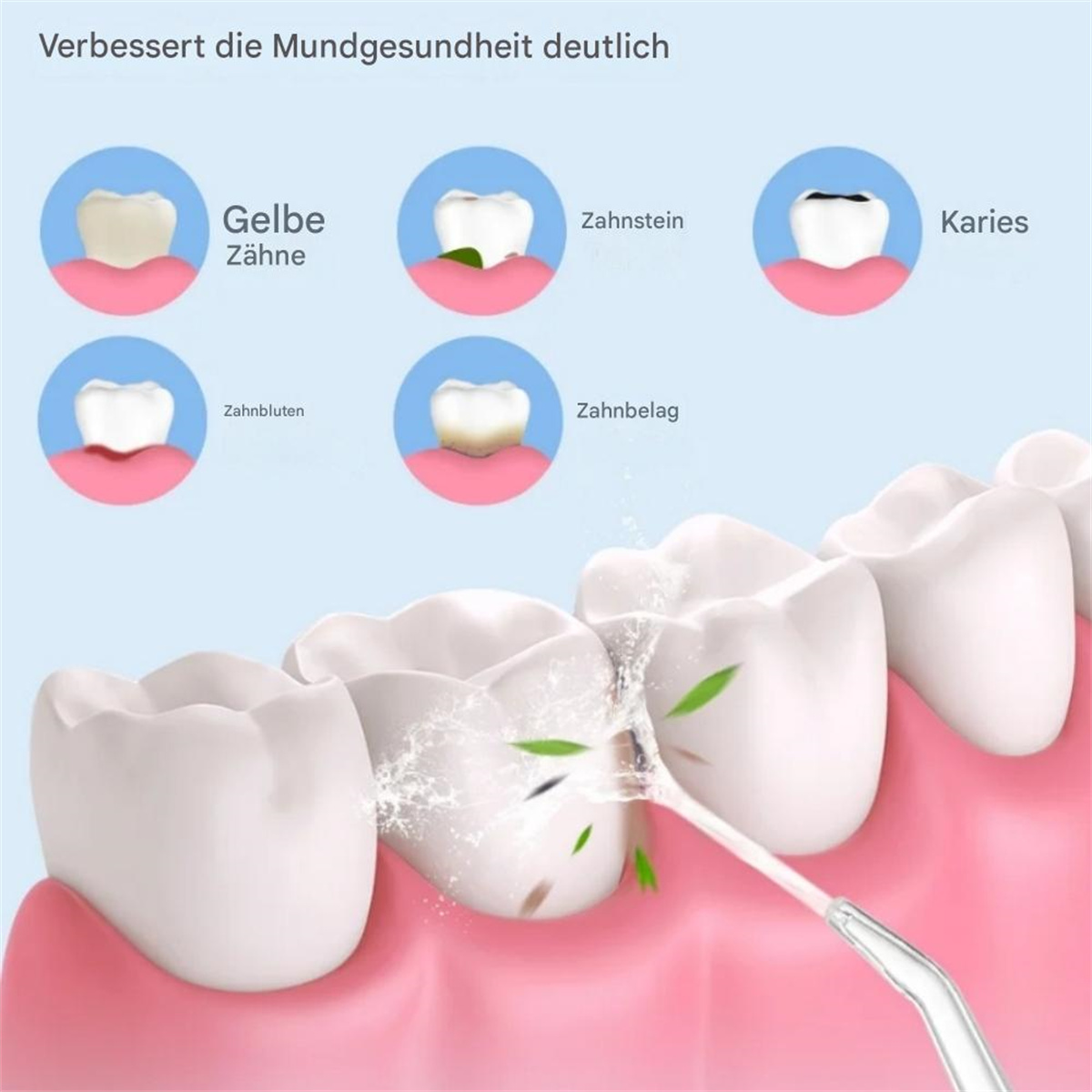 Diagramm, das Zahnprobleme veranschaulicht: gelbe Zähne, Zahnstein, Karies und mehr.
