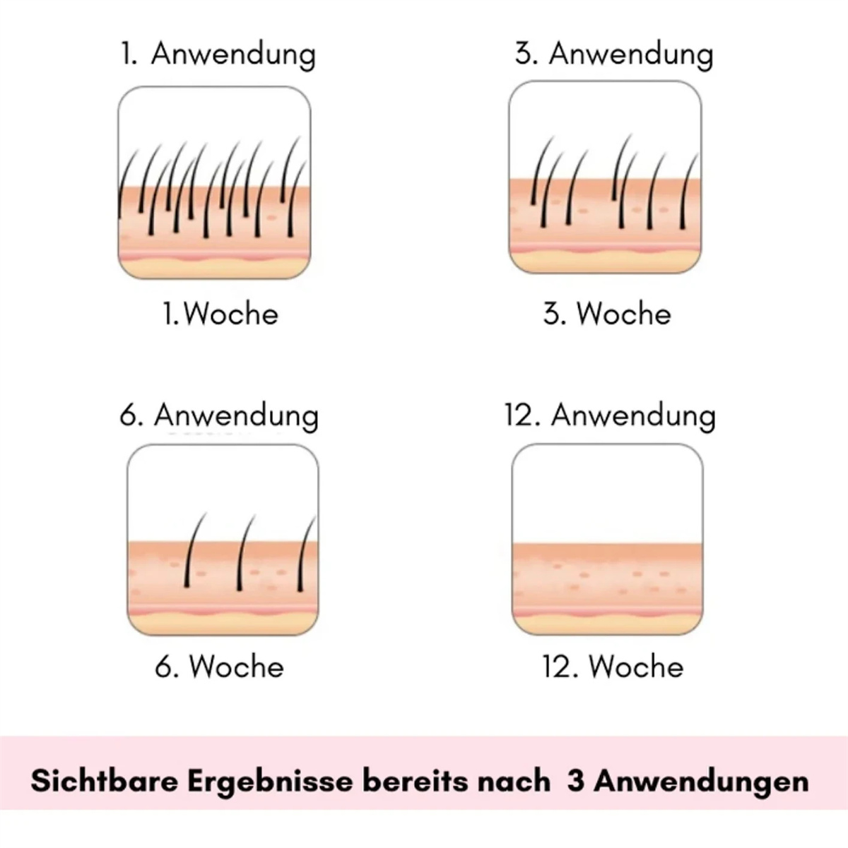 Diagramm, das die Haarwachstumsstadien nach der Anwendung eines Produkts zeigt. Das Diagramm zeigt die Ergebnisse.