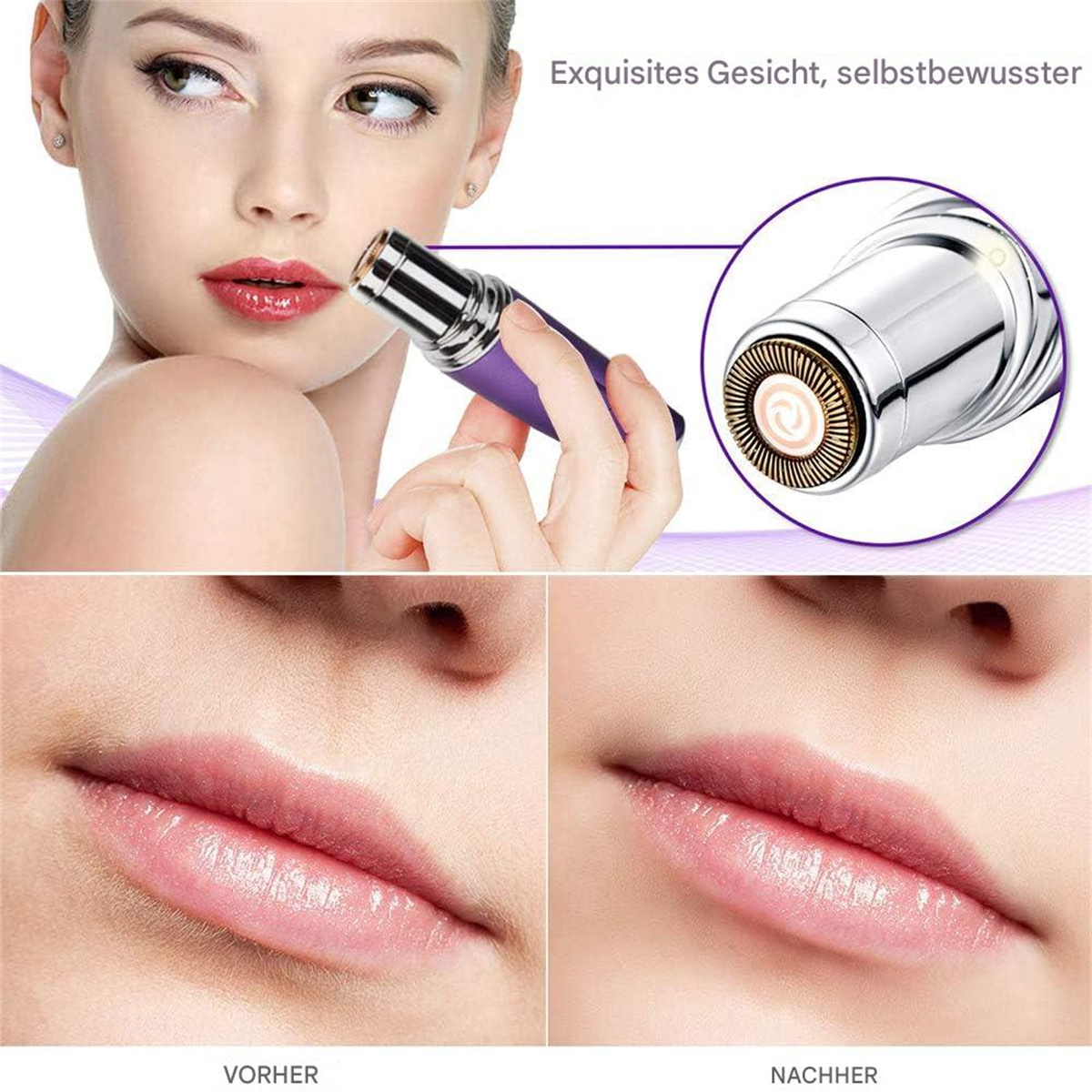 Frau benutzt violettes Haarentfernungsgerät. Nahaufnahmen zeigen vorher und nachher der Lippenhaarentfernung.