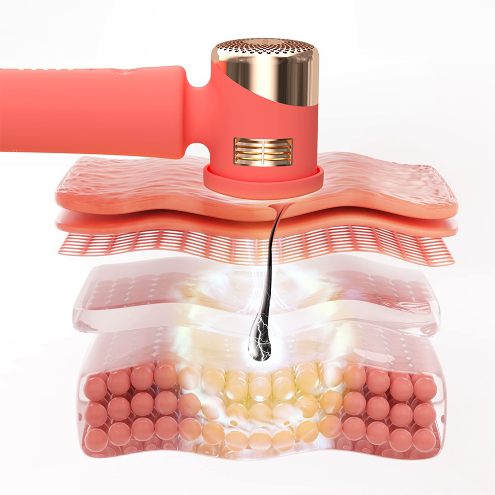 Diagram of skin layers with a device, showing hair removal process.