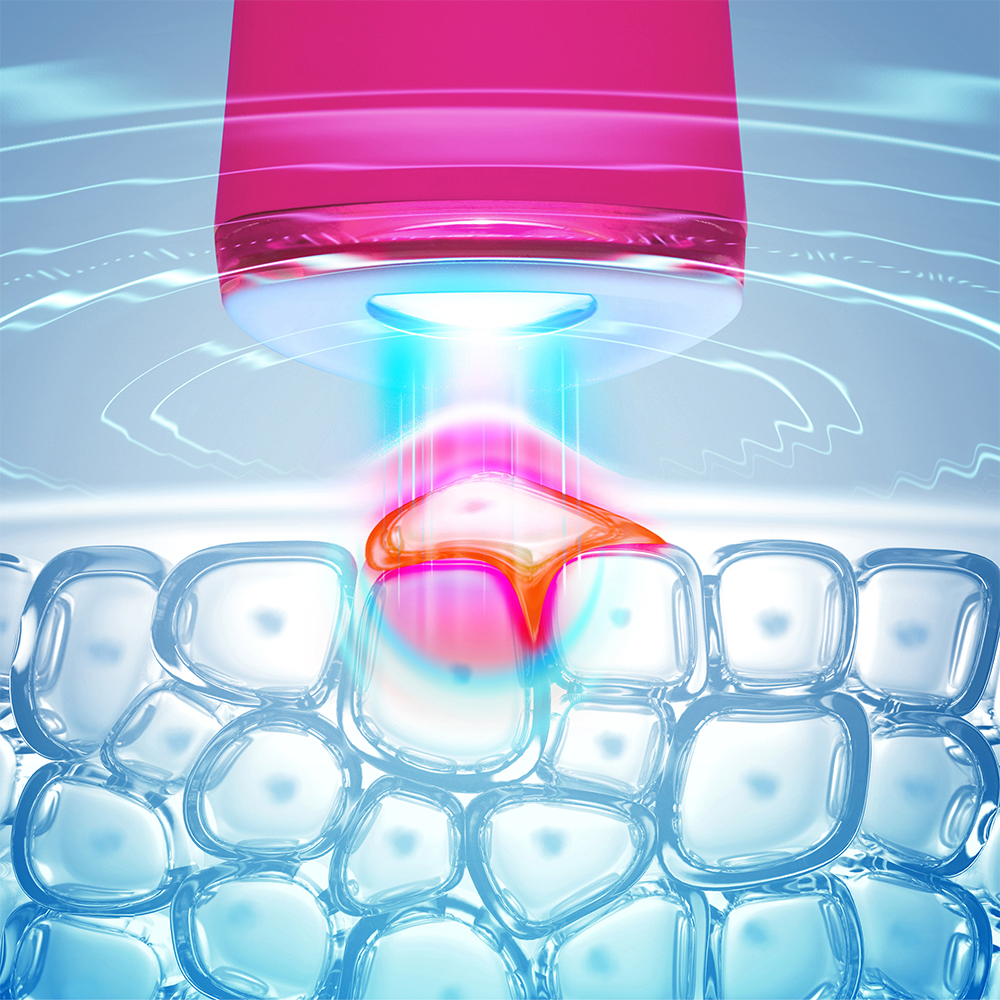 Close-up of skin receiving treatment. A red, glowing light interacts with the cells.