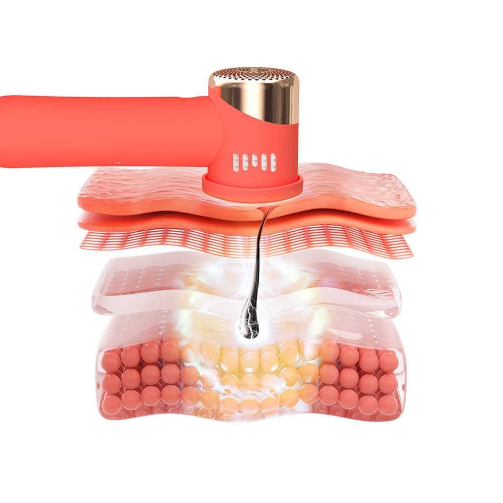 A beauty device cutting through skin layers. It shows hair follicle and layers of skin.