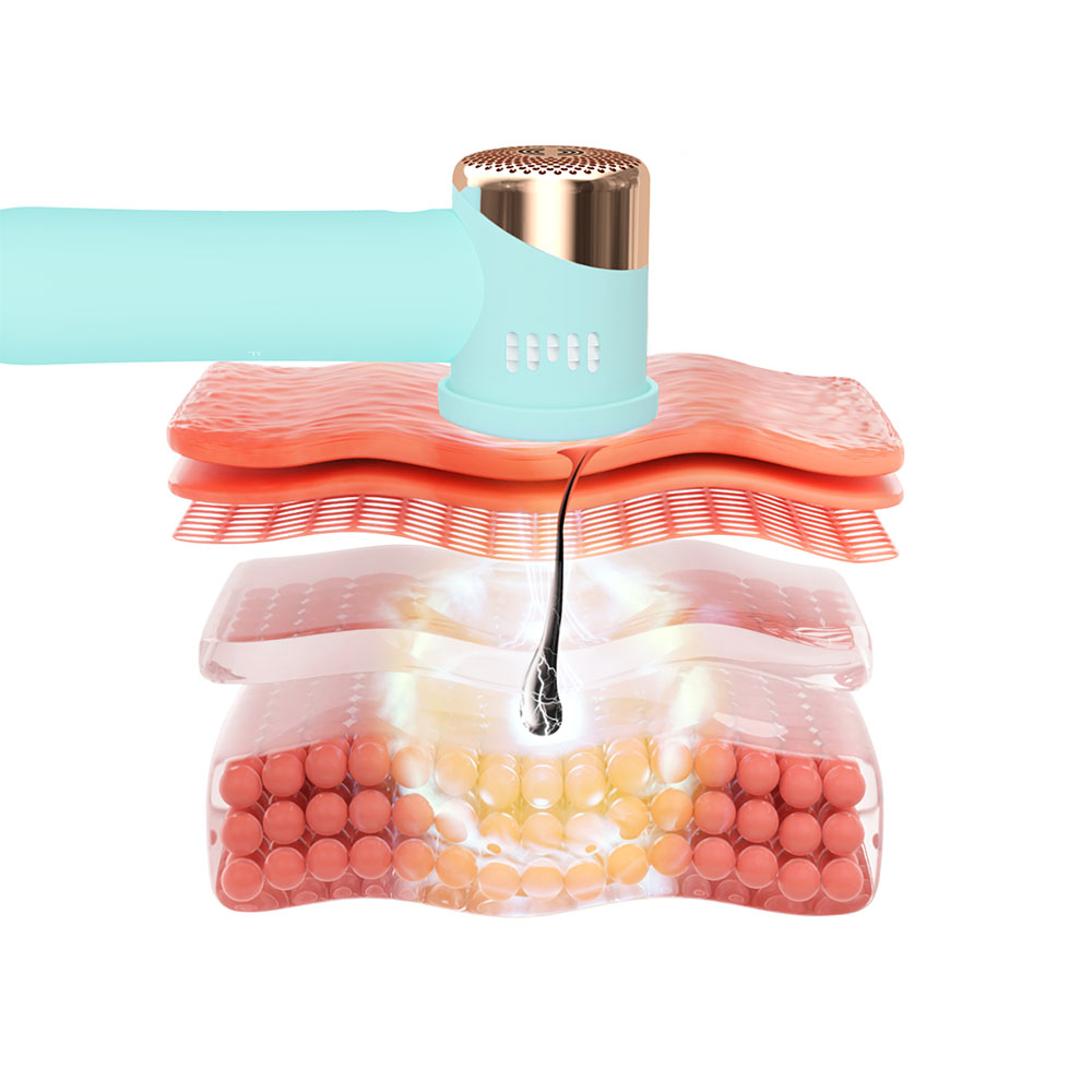 An illustration shows skin layers with a teal device removing a hair.